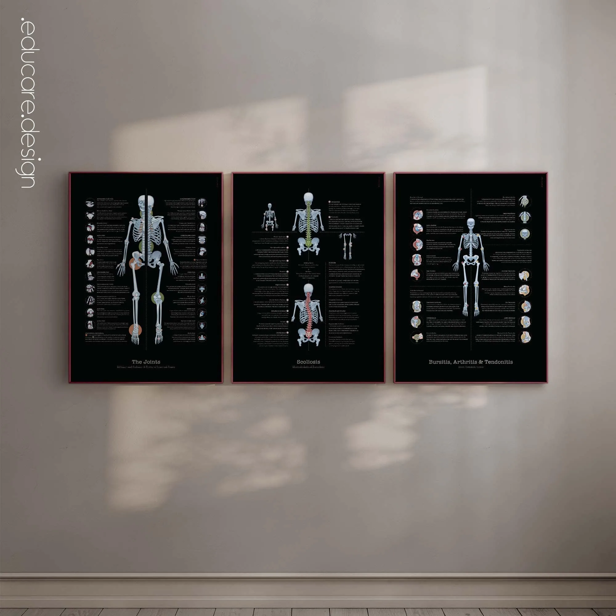 Foot, Knee and Hand Anatomy Set anatomy chart for clinics Foot, Knee and Hand Anatomy Set anatomy chart for clinics