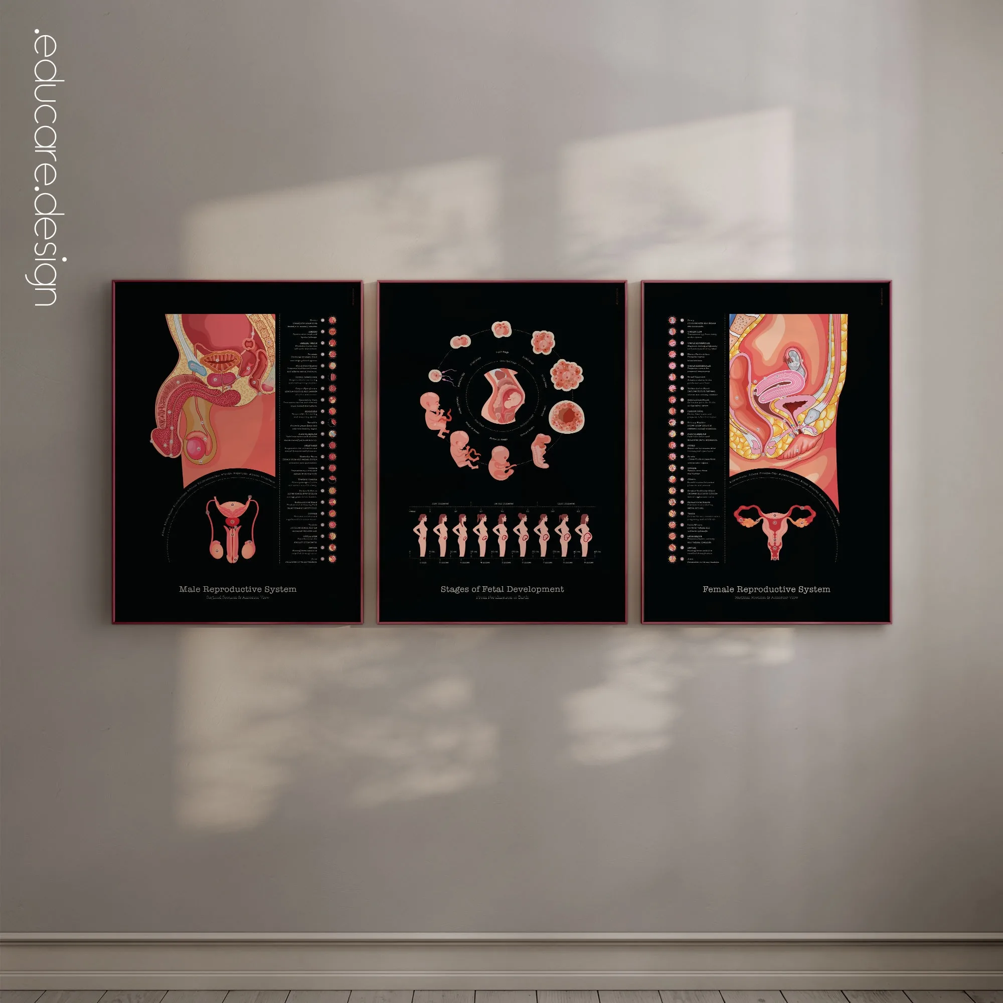 Female Reproductive System anatomy chart for clinics Female Reproductive System anatomy chart for clinics