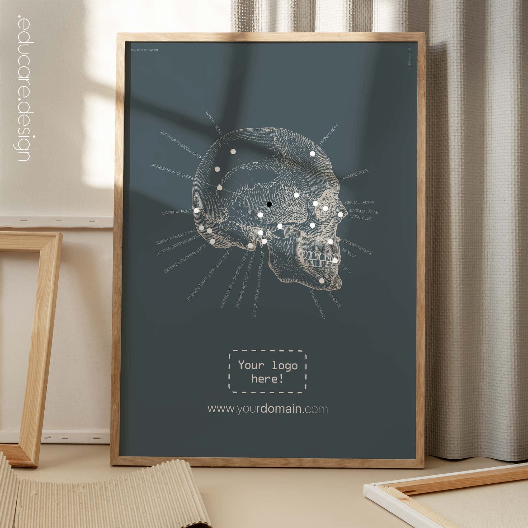 Ossa craniche laterali