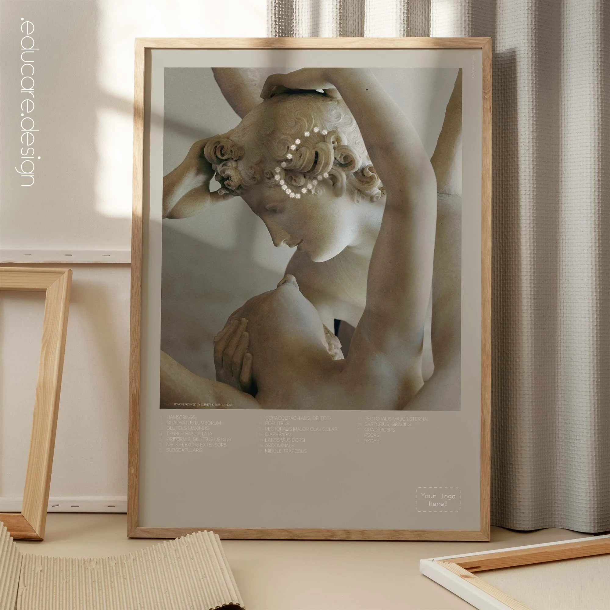 Temporal Sphenoid Line