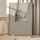 Linea sfenoidale temporale