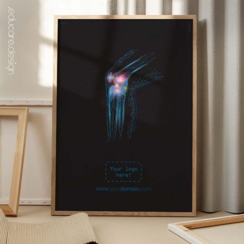 Borsite al ginocchio