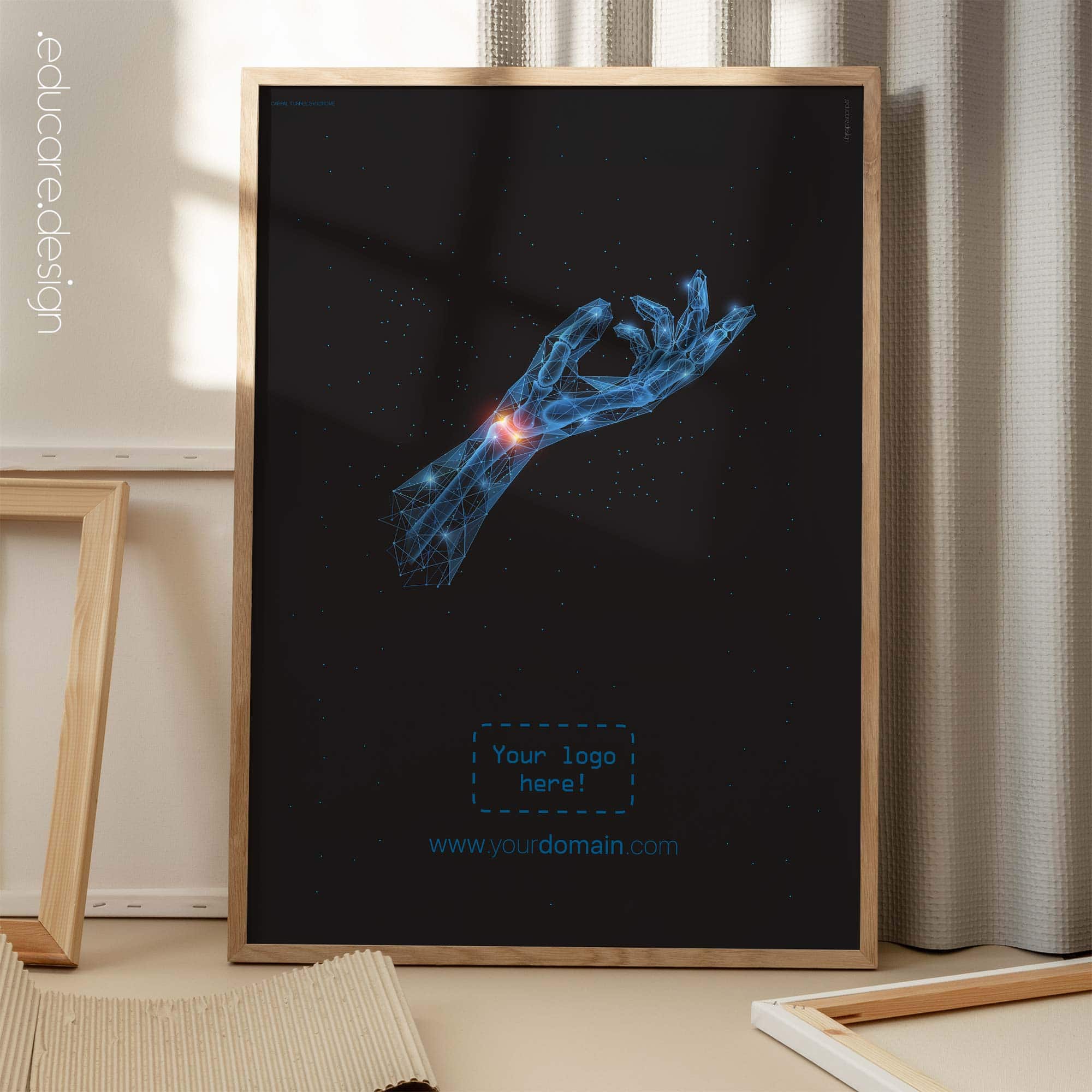 Carpal Tunnel Syndrome