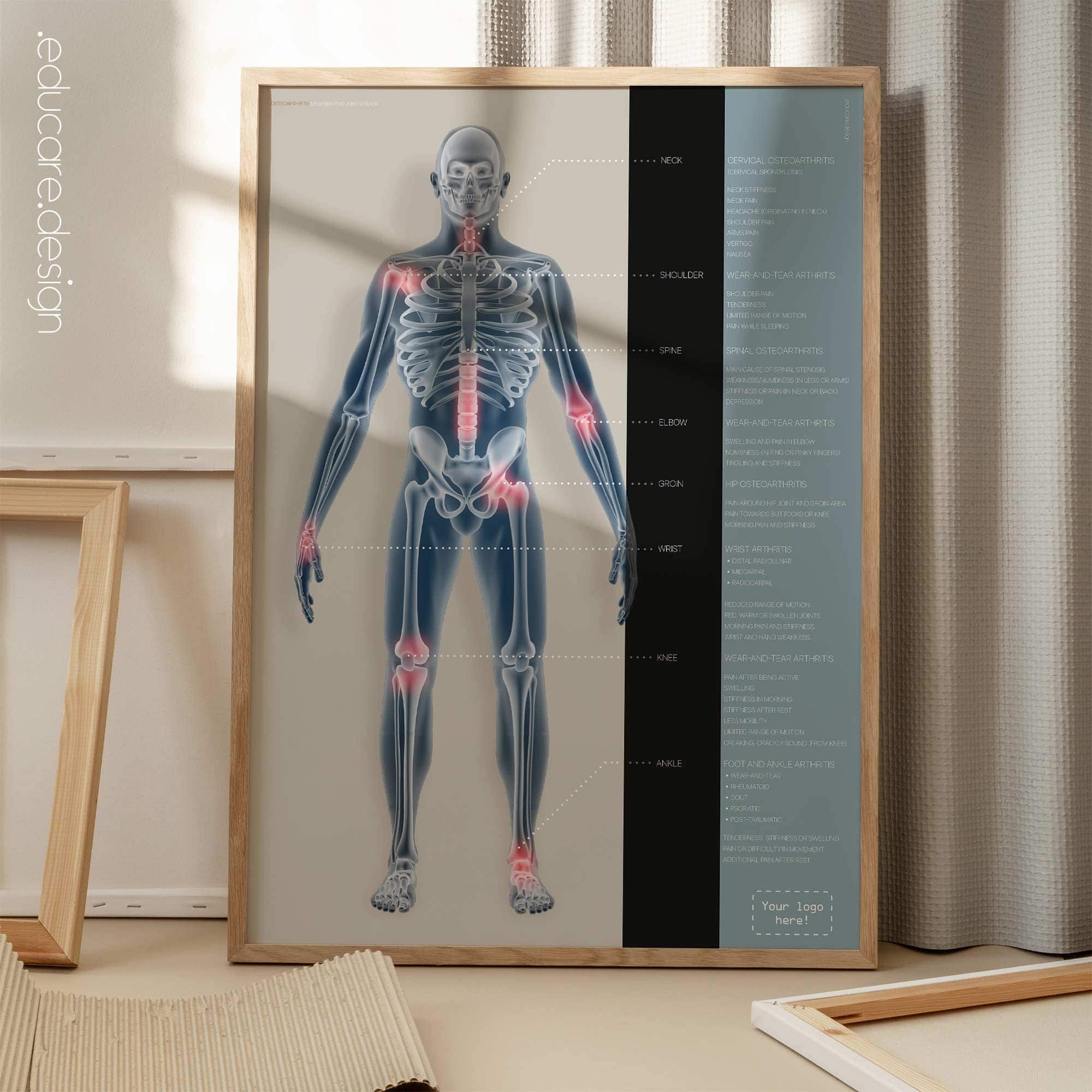 Osteoartrite. Opere d'arte di anatomia e fisiologia da educare.design