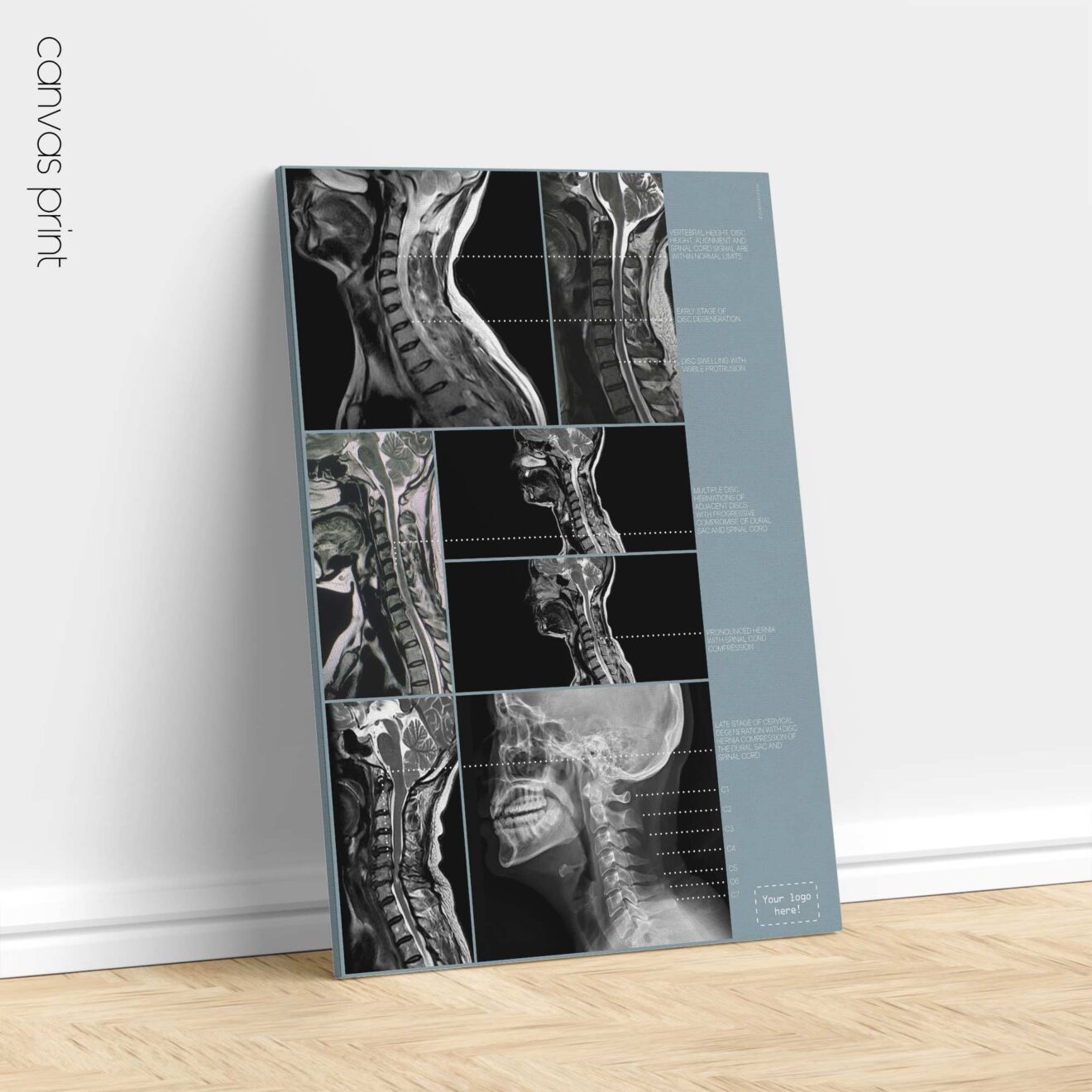 Kunstwerk zur Zervikalpathologie von educare.design
