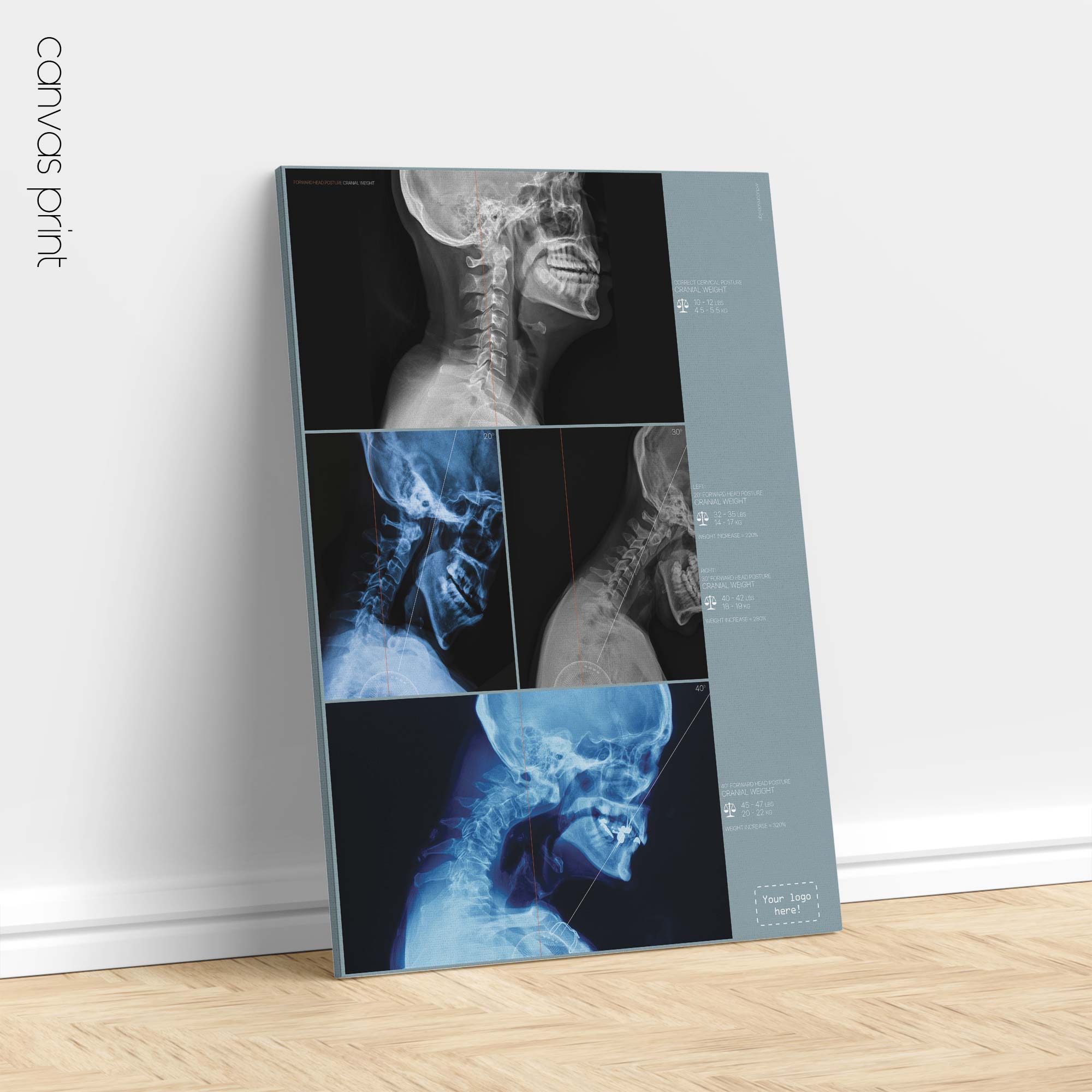 Postura della testa in avanti