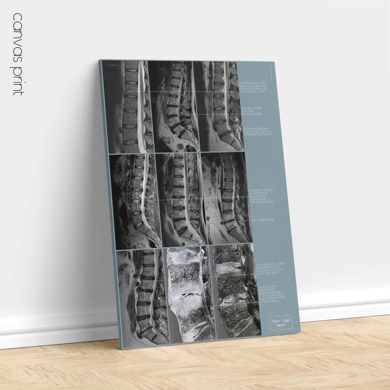 Opere d'arte sulla patologia lombare da educare.design