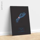 Carpal Tunnel Syndrome