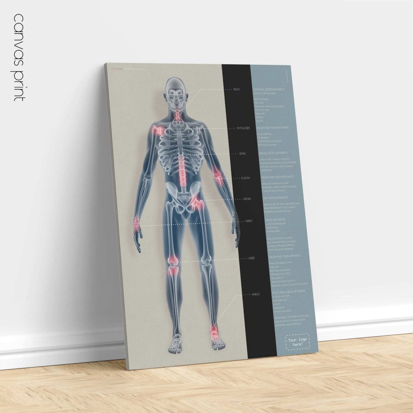 Arthrose. Dessin d'anatomie et de physiologie d'educare.design