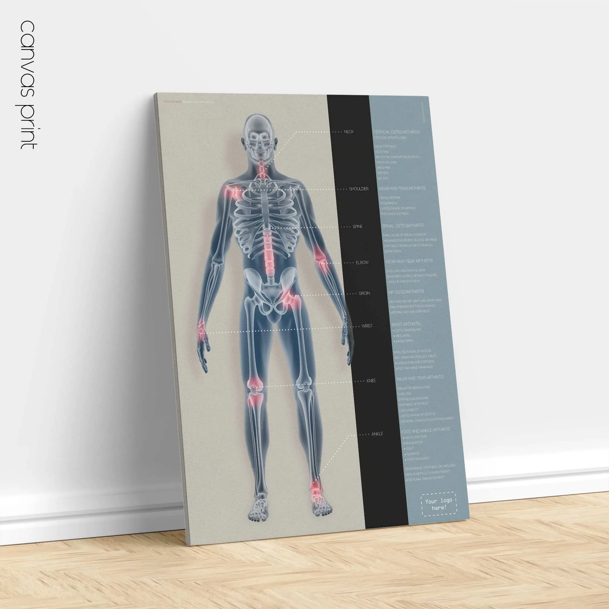 Dermatomes and Cutaneous Nerve Innervation anatomy chart for clinics Dermatomes and Cutaneous Nerve Innervation anatomy chart for clinics