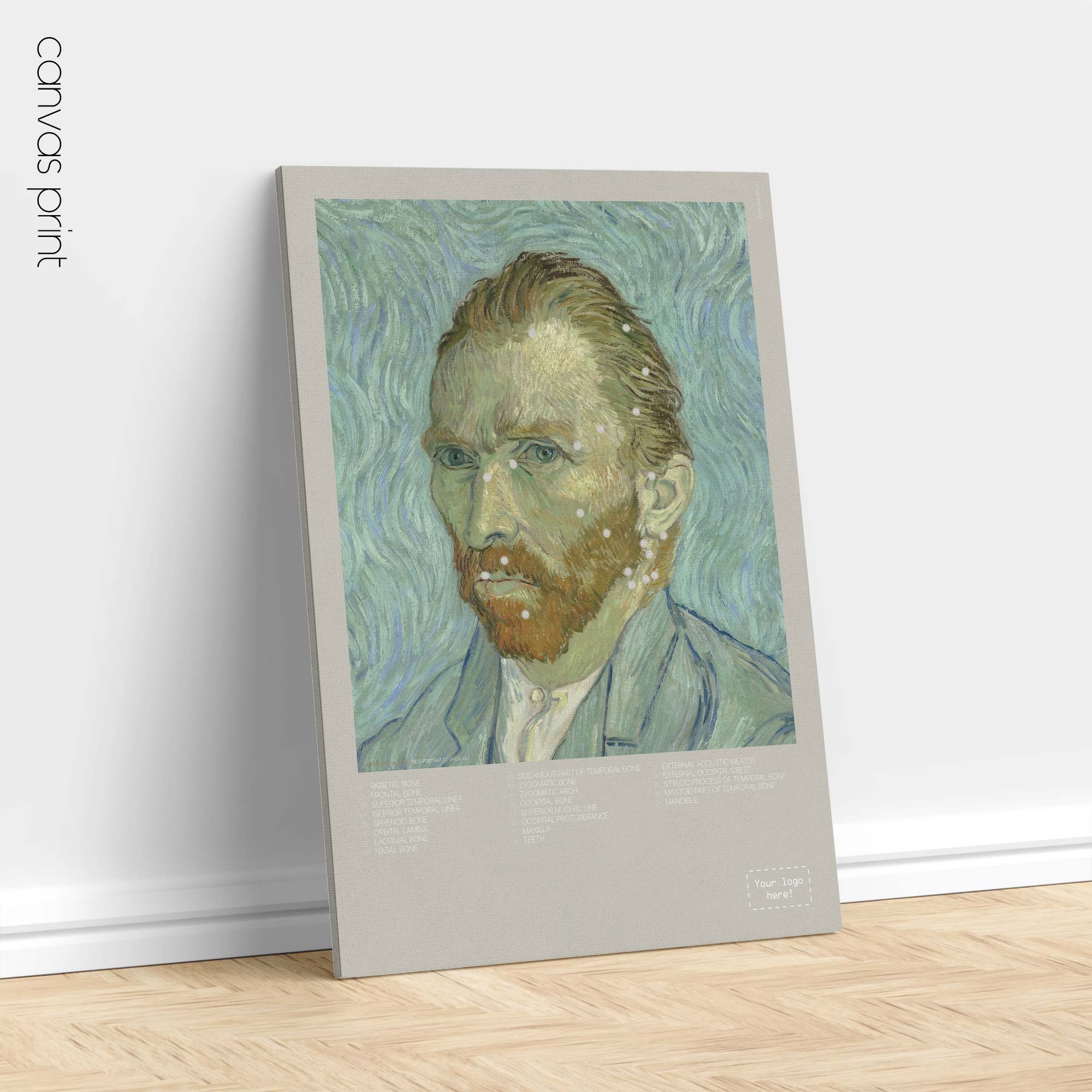 Lateral Cranial Bones