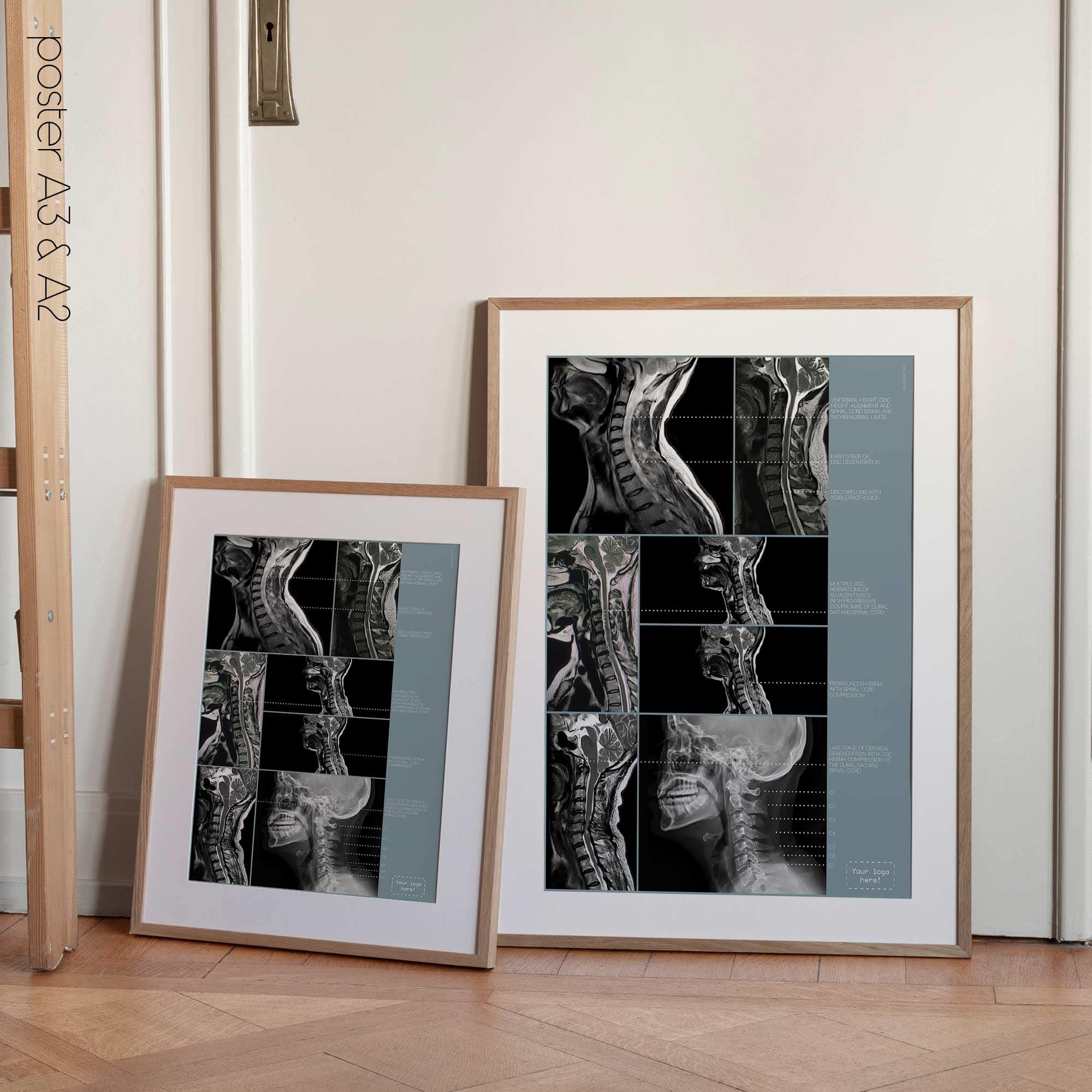 Opere d'arte sulla patologia cervicale da educare.design