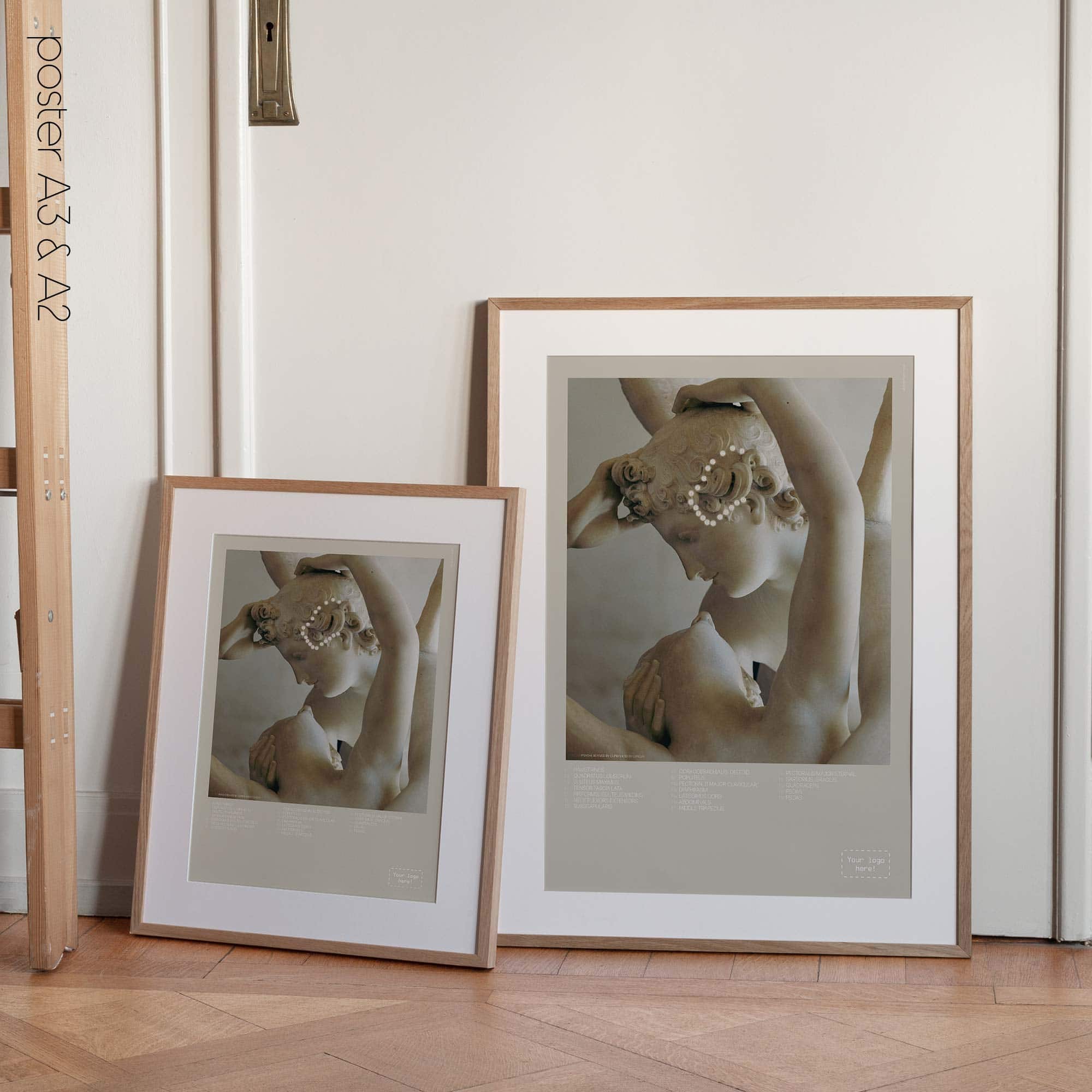 Temporal Sphenoid Line