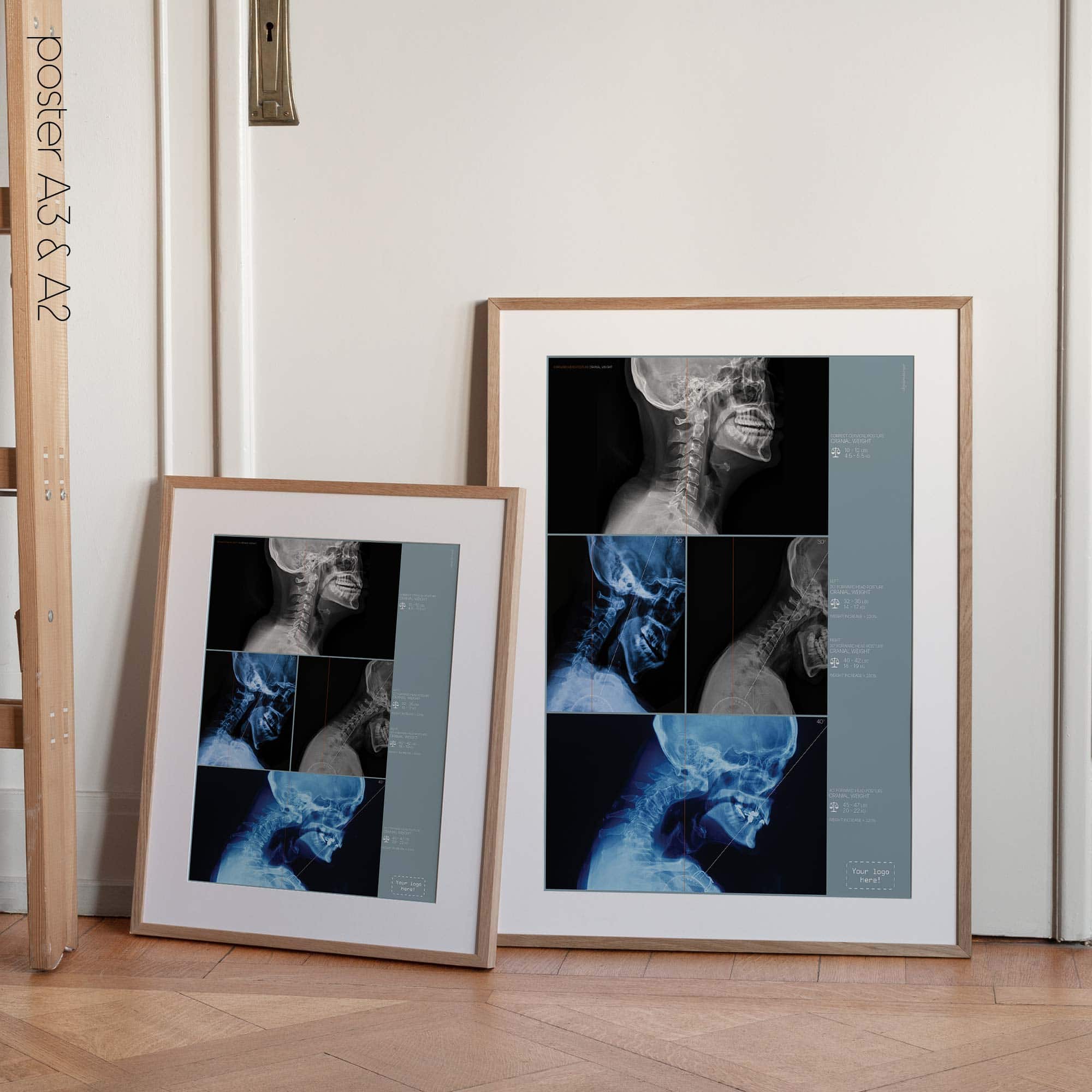 Postura della testa in avanti