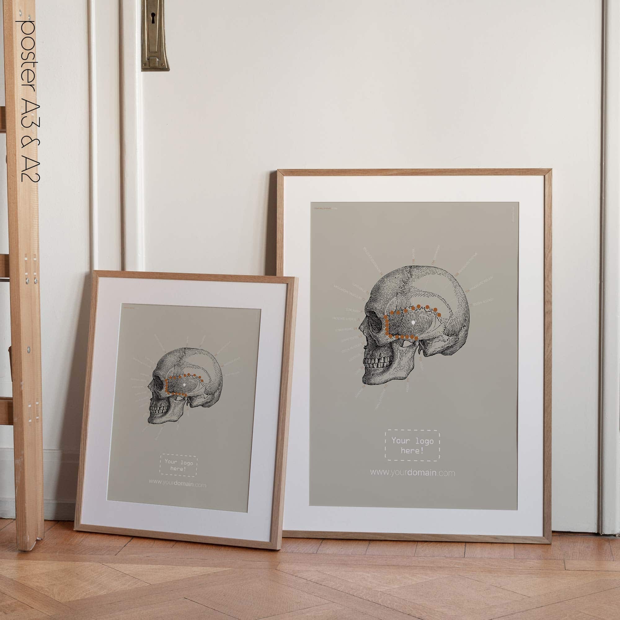 Linea sfenoidale temporale