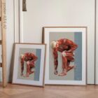 Injuries and Ailments (chronic and acute) – educare.design Lesioni e disturbi. Opere d'arte di anatomia e fisiologia da educare.design