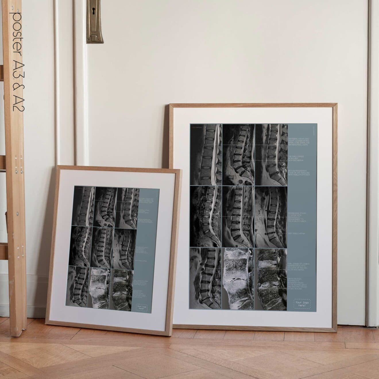 Opere d'arte sulla patologia lombare da educare.design