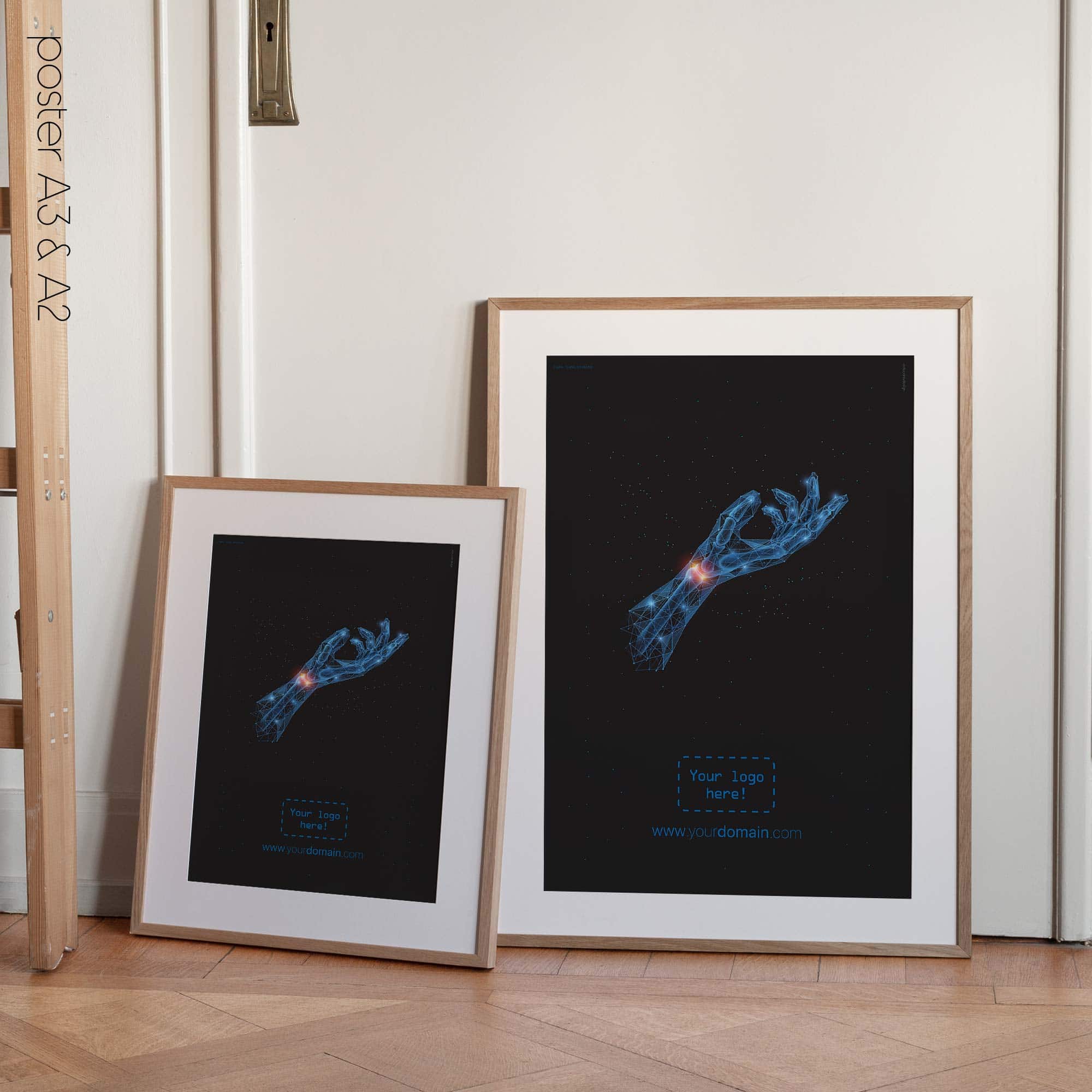 Carpal Tunnel Syndrome