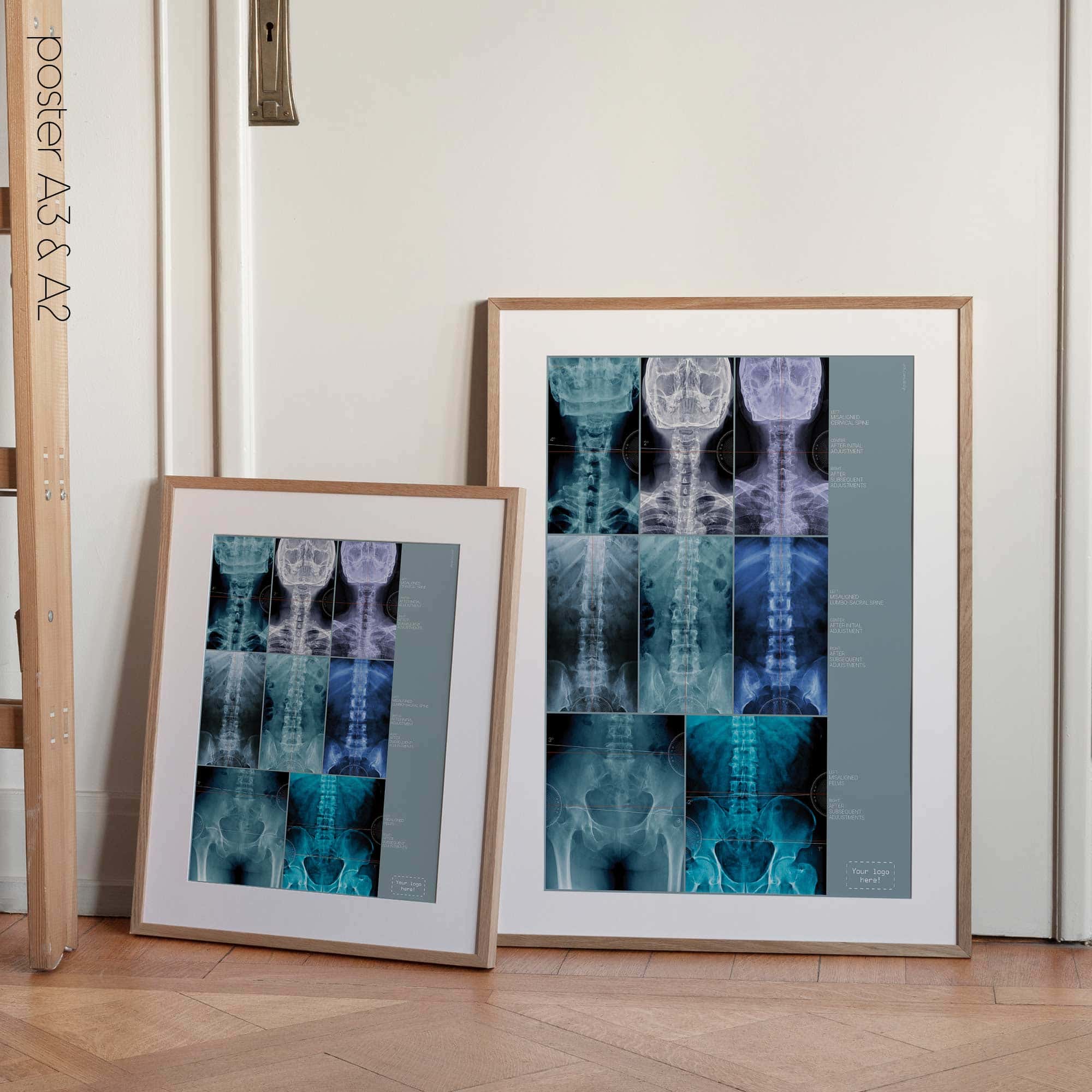 Fehlausrichtung, Anatomie und Physiologie - Kunstwerke von educare.design