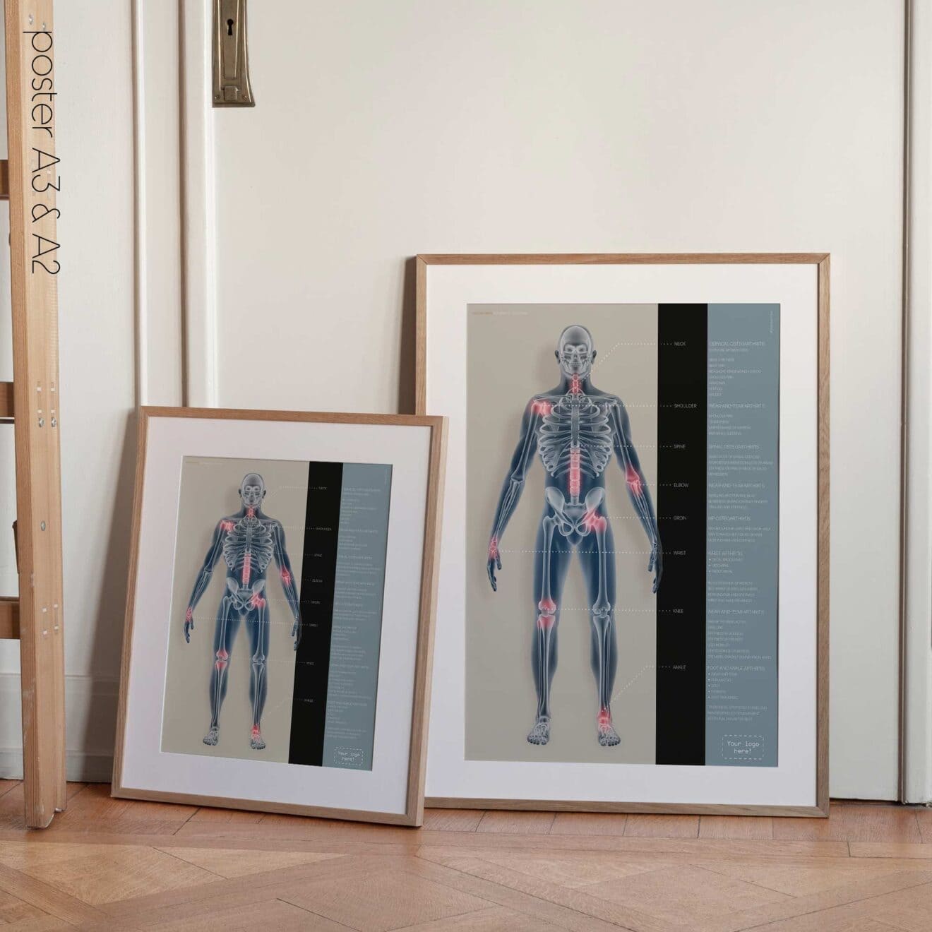 Arthrose. Dessin d'anatomie et de physiologie d'educare.design
