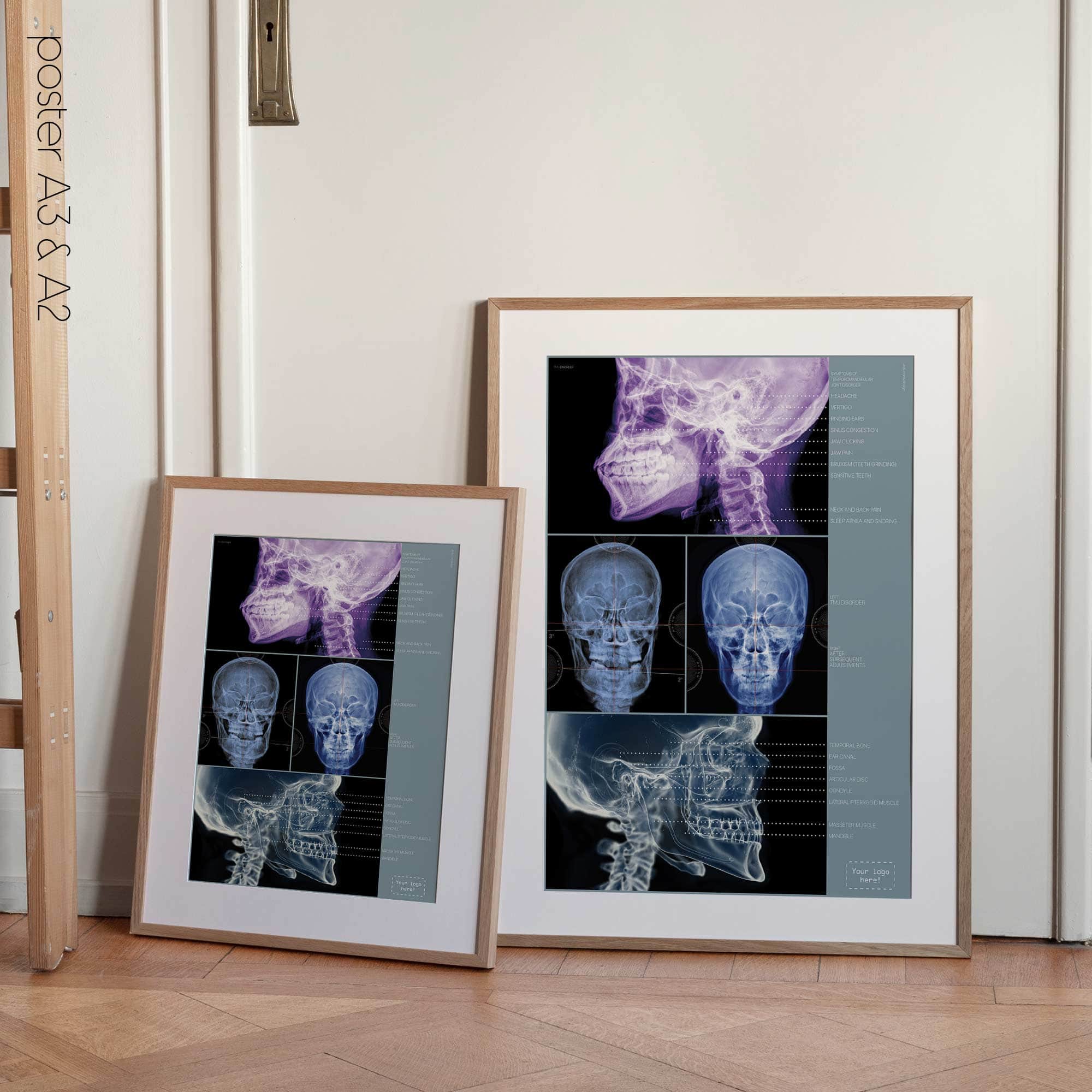 Disturbo dell'ATM. Opere d'arte di anatomia e fisiologia da educare.design