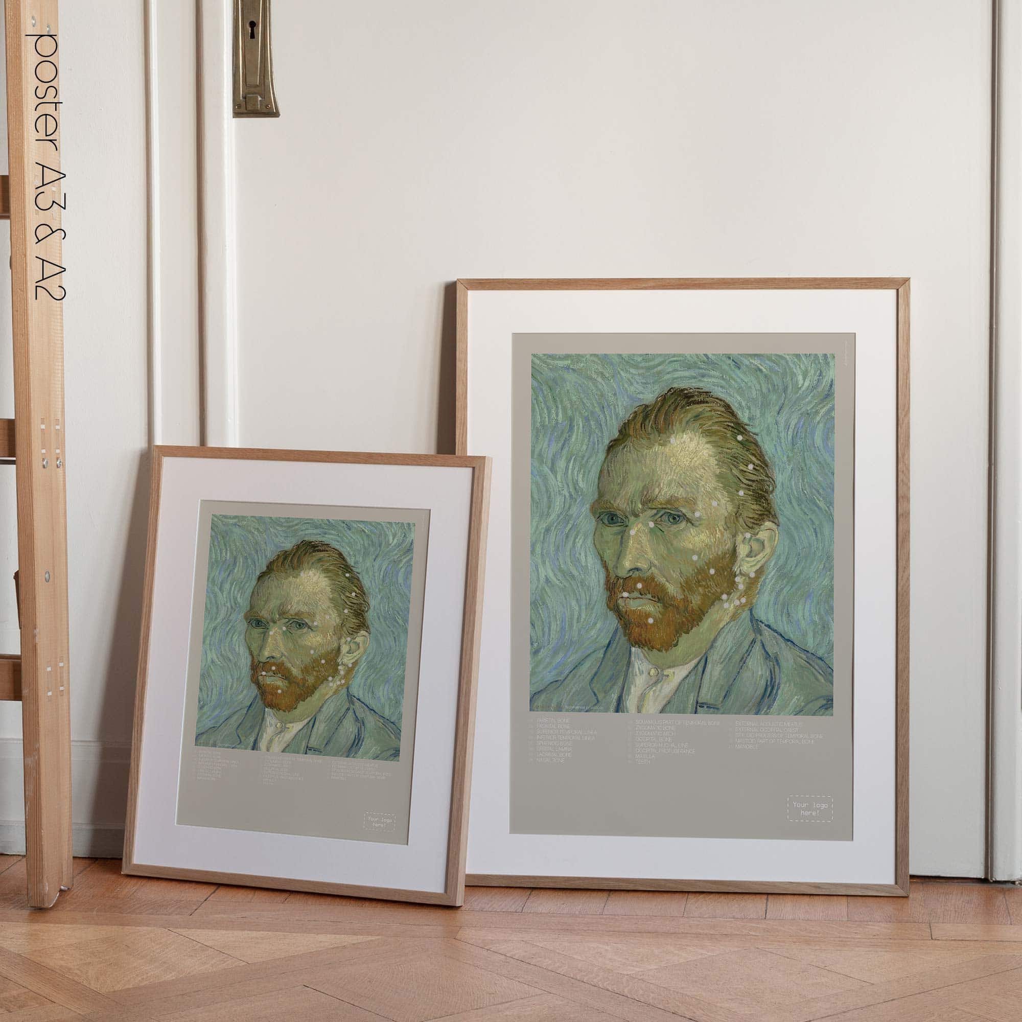 Lateral Cranial Bones