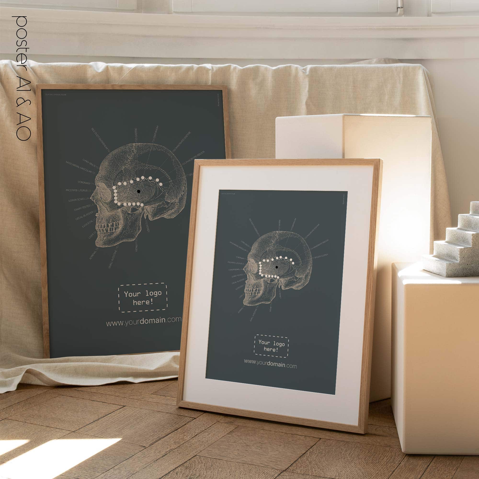 Linea sfenoidale temporale