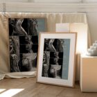 Opere d'arte sulla patologia cervicale da educare.design