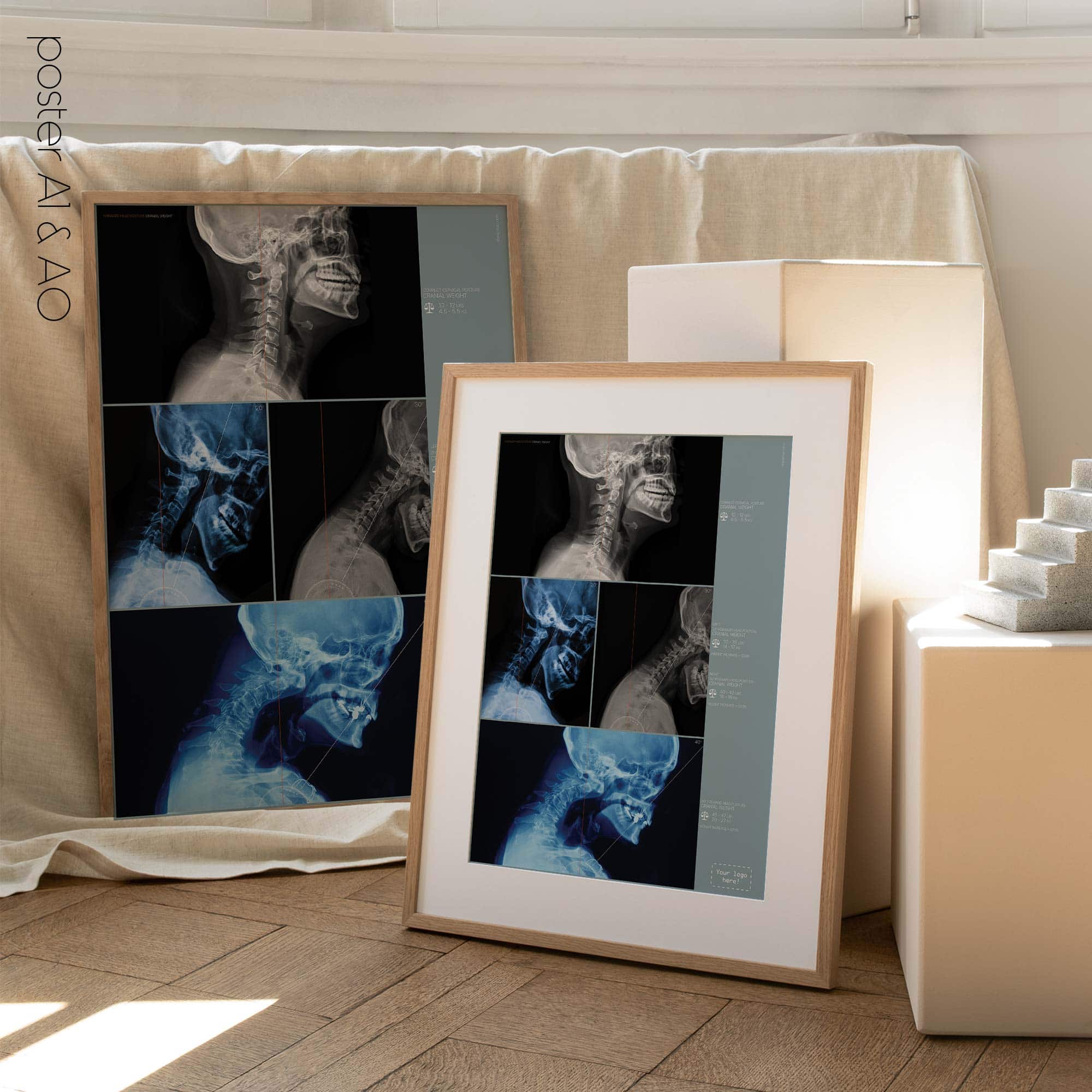 Postura della testa in avanti