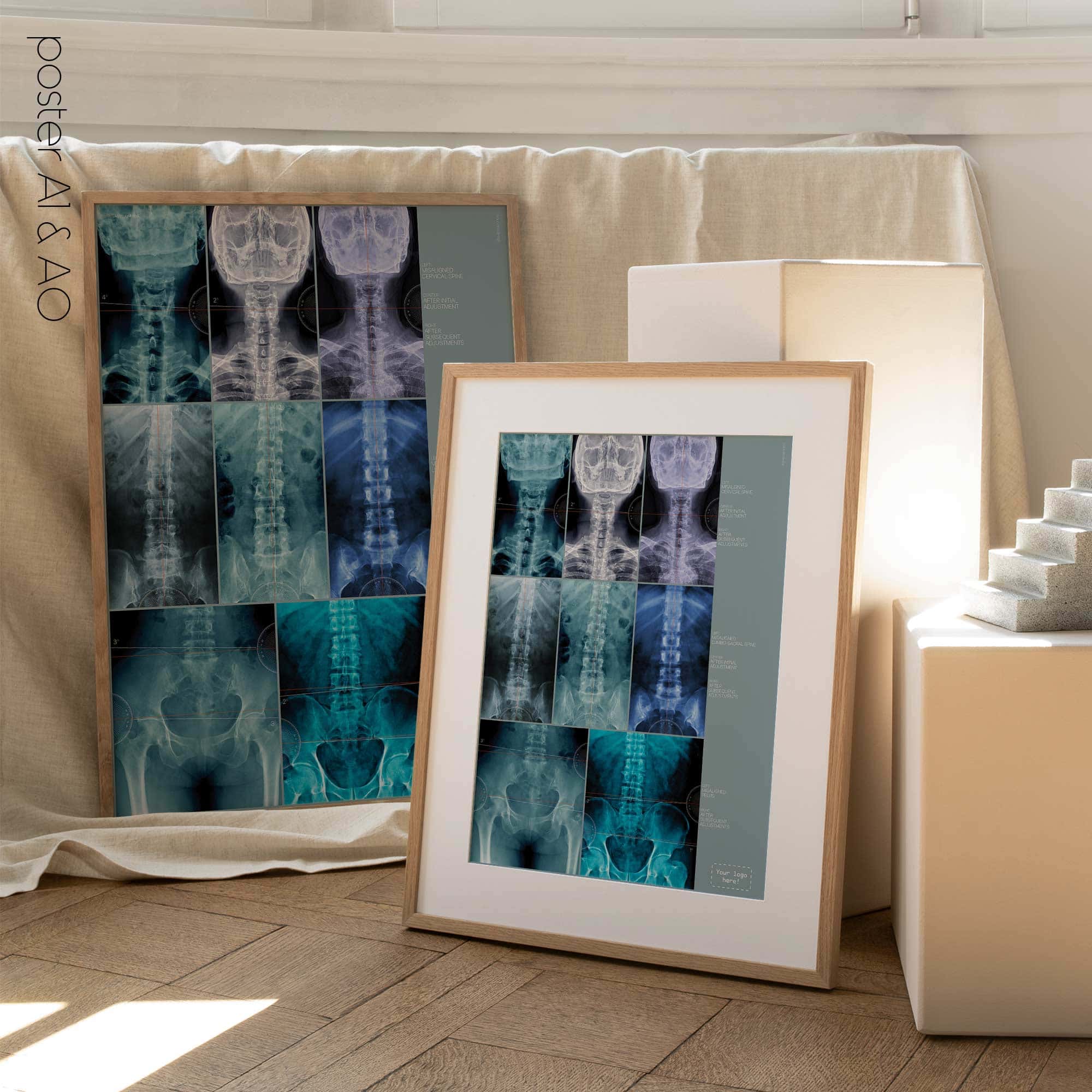 Fehlausrichtung, Anatomie und Physiologie - Kunstwerke von educare.design