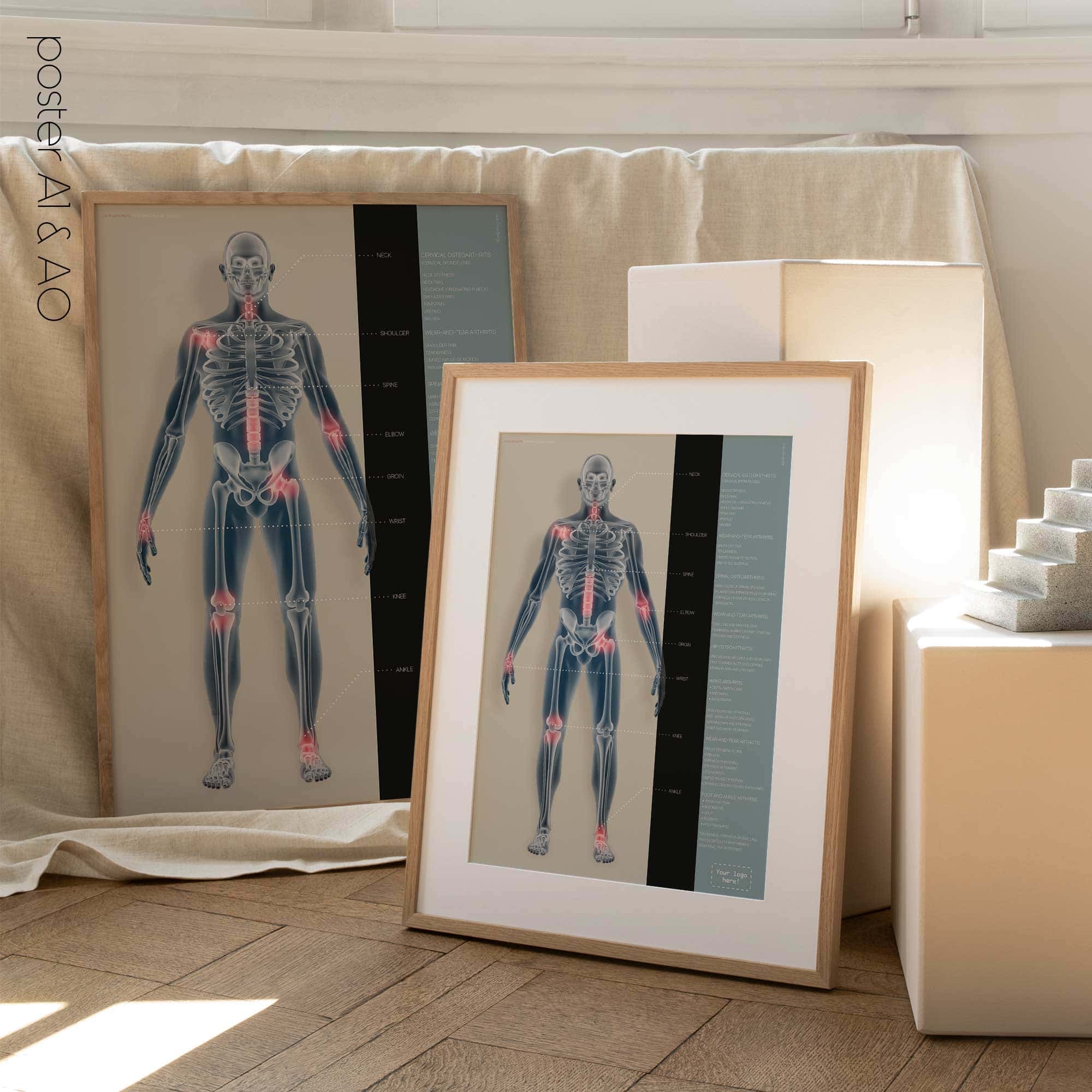 Osteoartrite. Opere d'arte di anatomia e fisiologia da educare.design