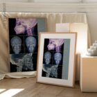 Disturbo dell'ATM. Opere d'arte di anatomia e fisiologia da educare.design