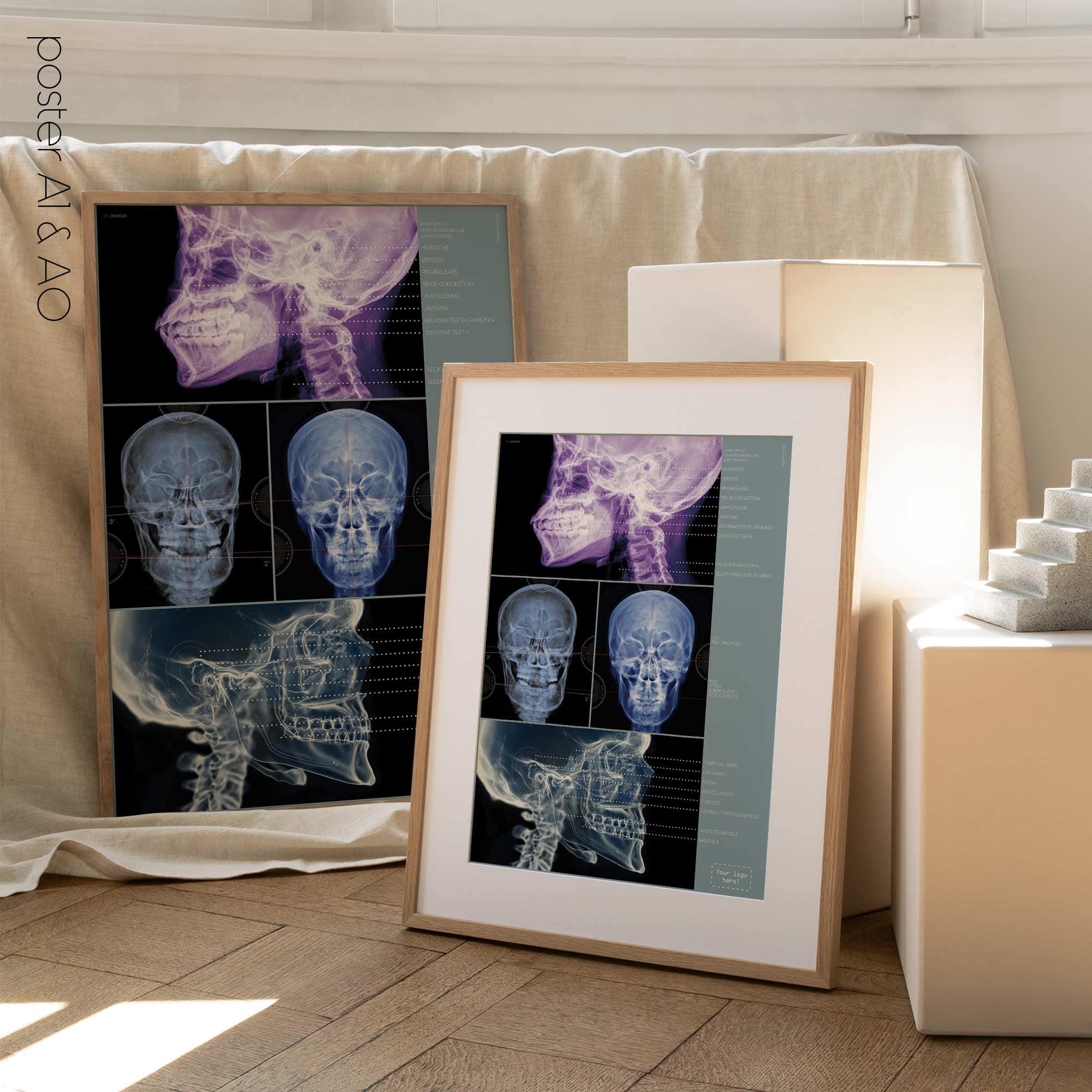 Disturbo dell'ATM. Opere d'arte di anatomia e fisiologia da educare.design