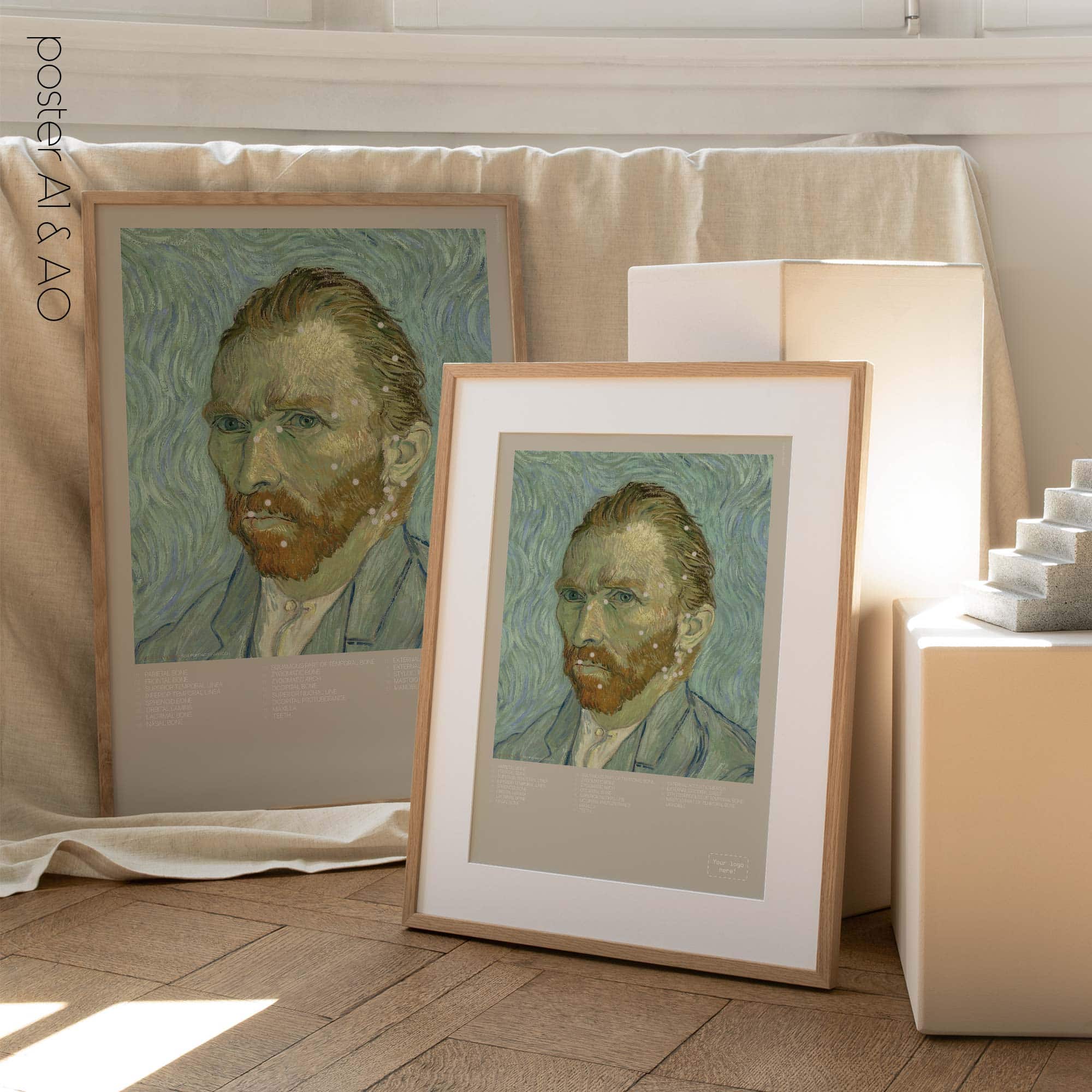 Lateral Cranial Bones