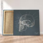 Linea sfenoidale temporale