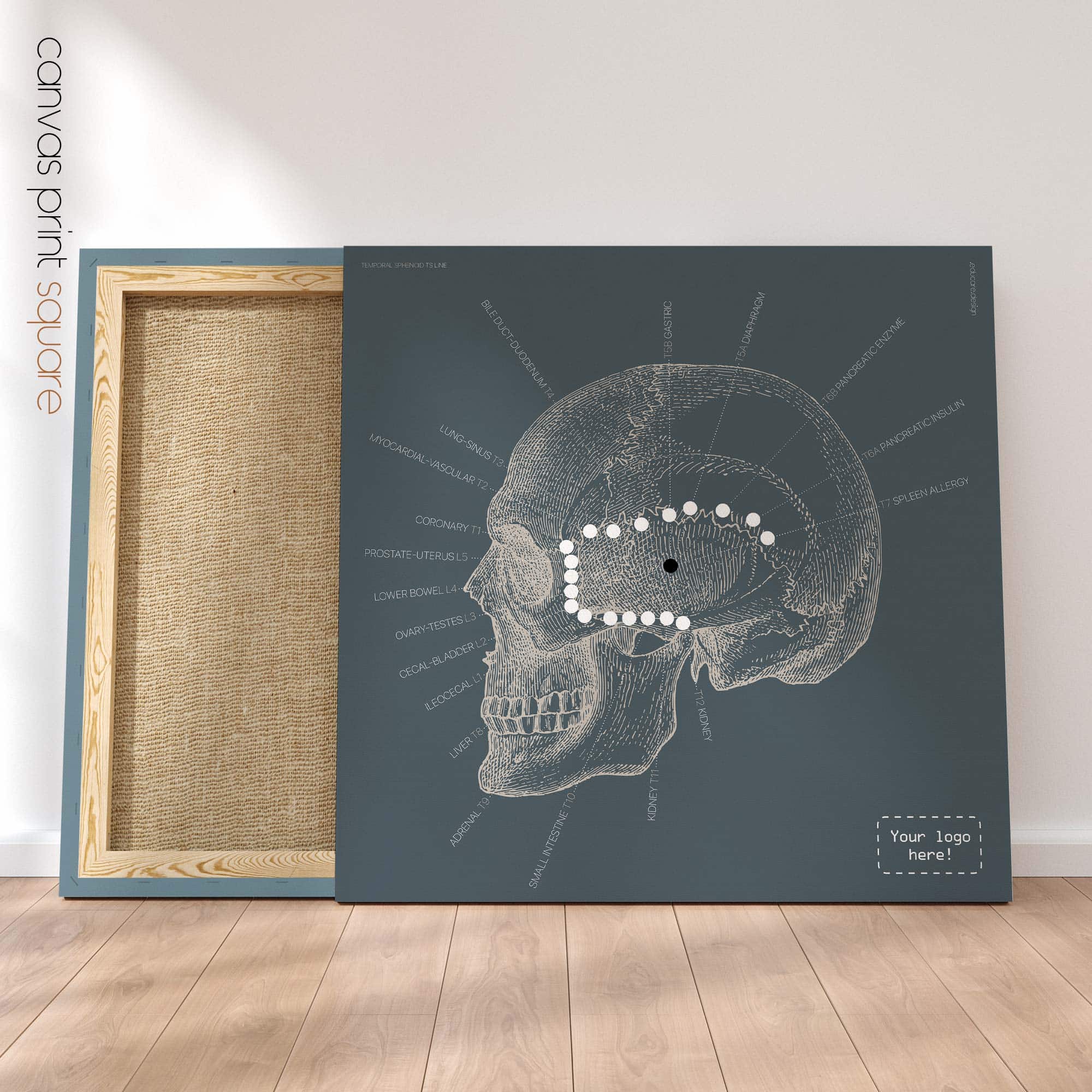 Linea sfenoidale temporale