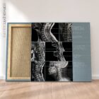 Opere d'arte sulla patologia cervicale da educare.design