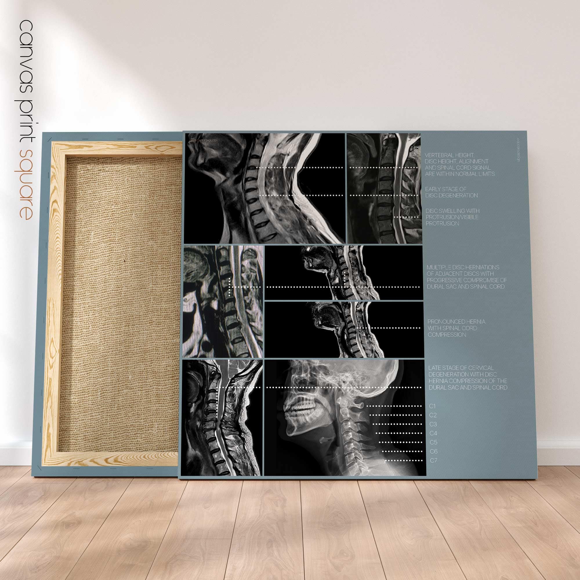 Opere d'arte sulla patologia cervicale da educare.design