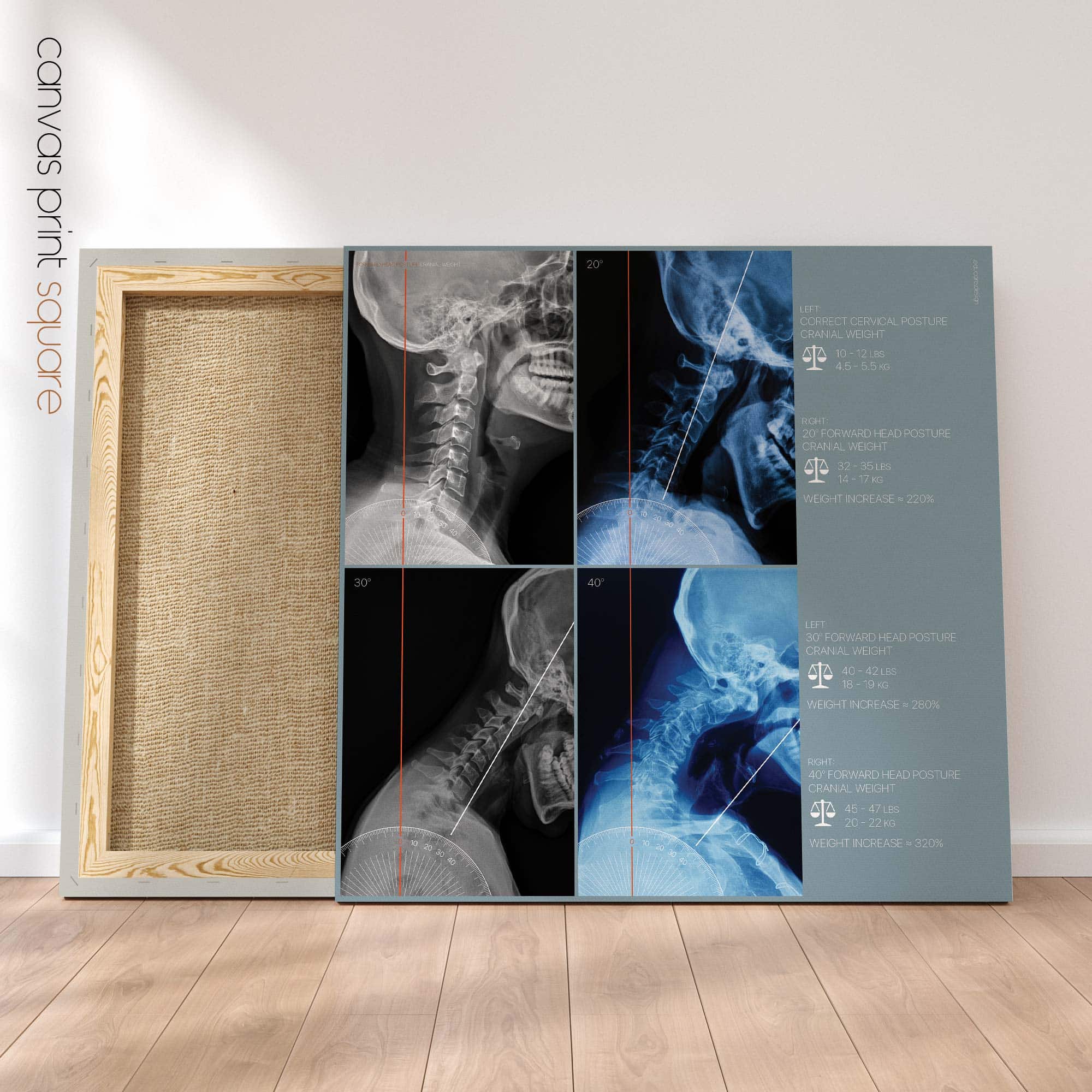 Postura della testa in avanti