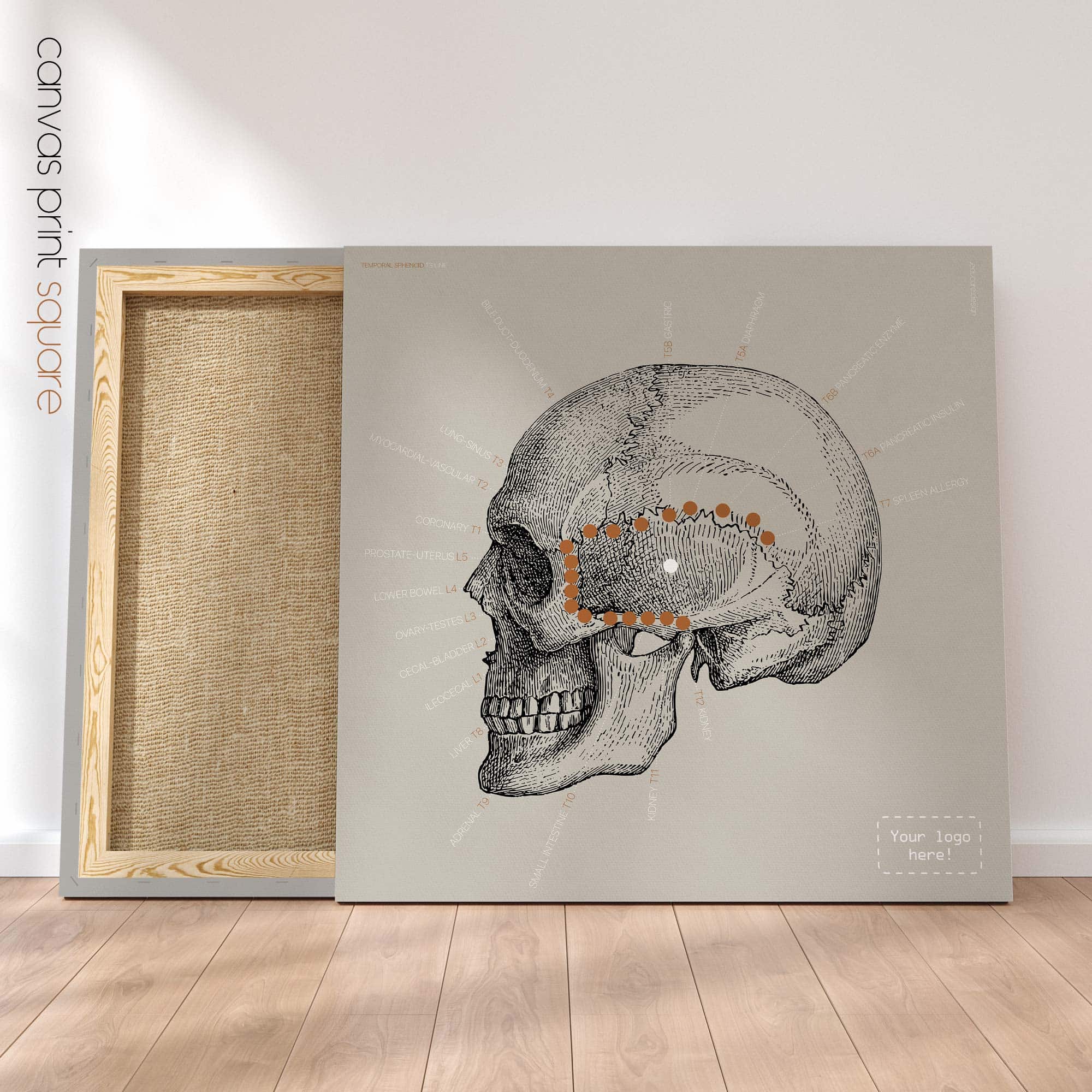 Linea sfenoidale temporale