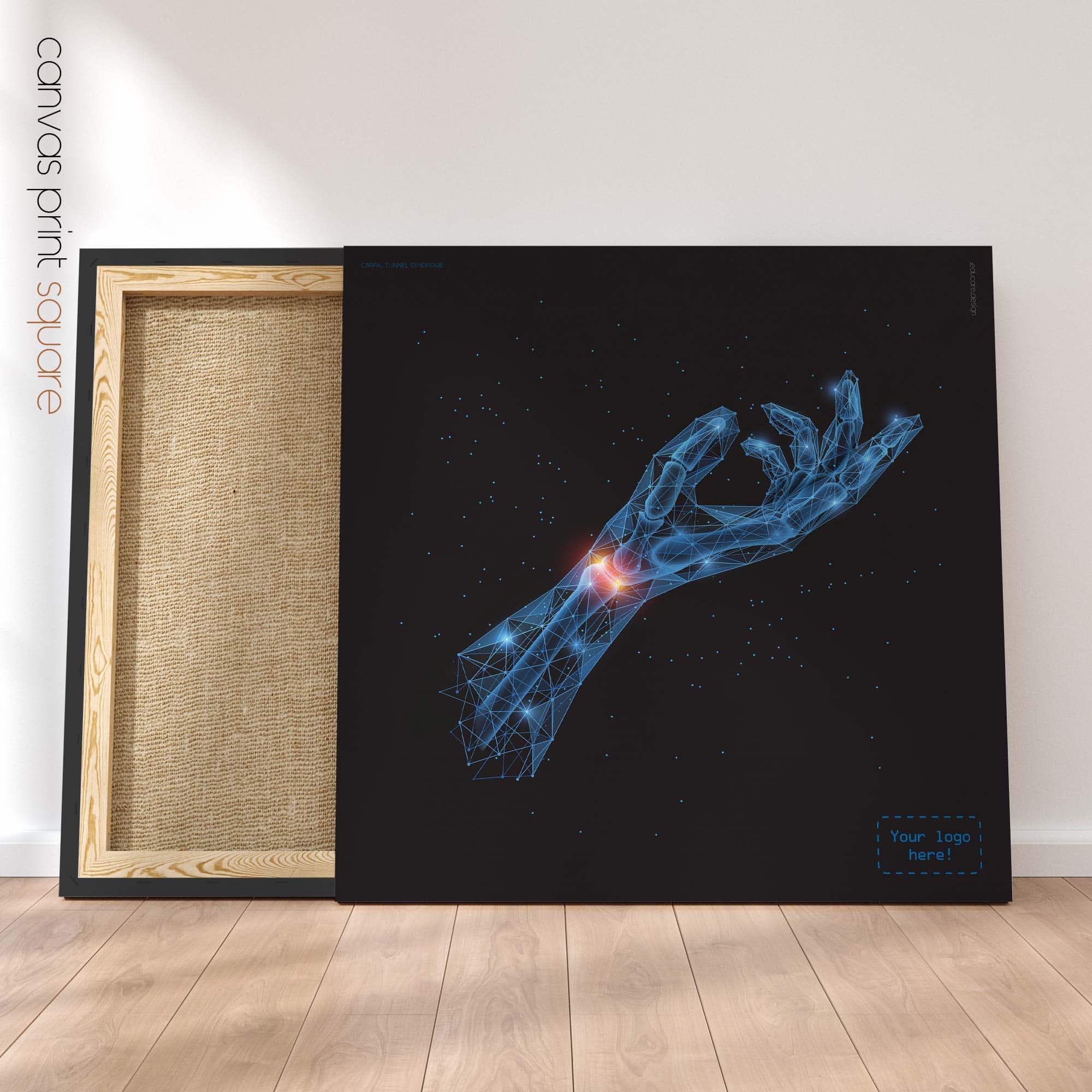 Carpal Tunnel Syndrome