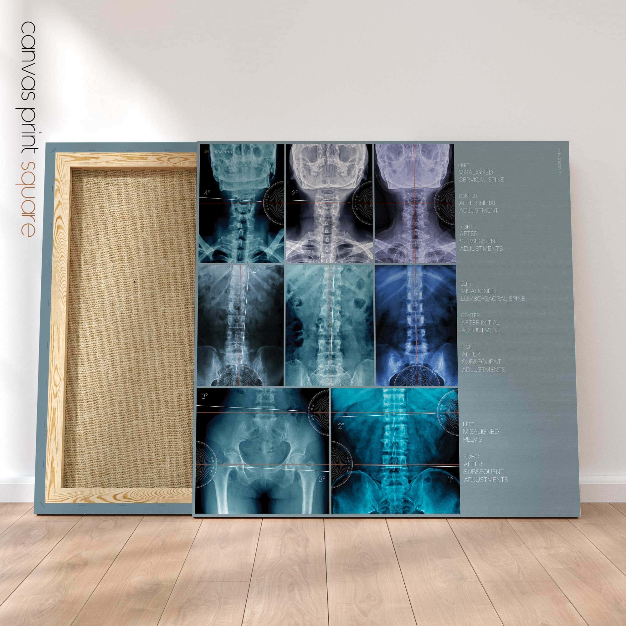 Fehlausrichtung, Anatomie und Physiologie - Kunstwerke von educare.design