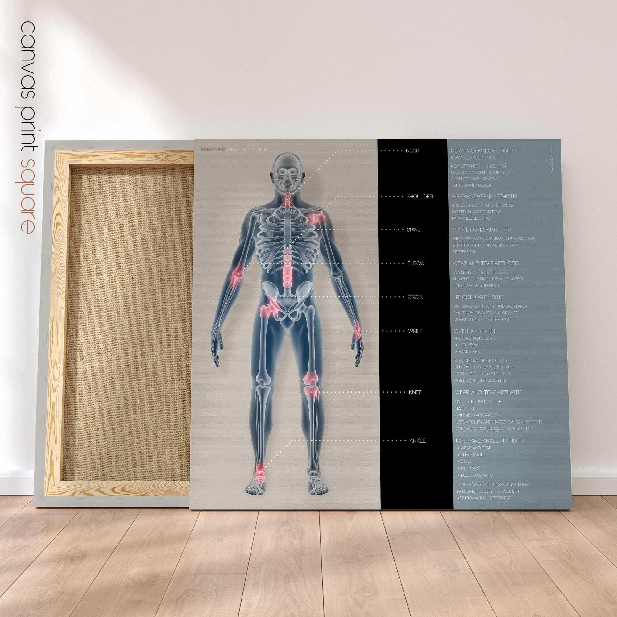 Osteoartrite. Opere d'arte di anatomia e fisiologia da educare.design