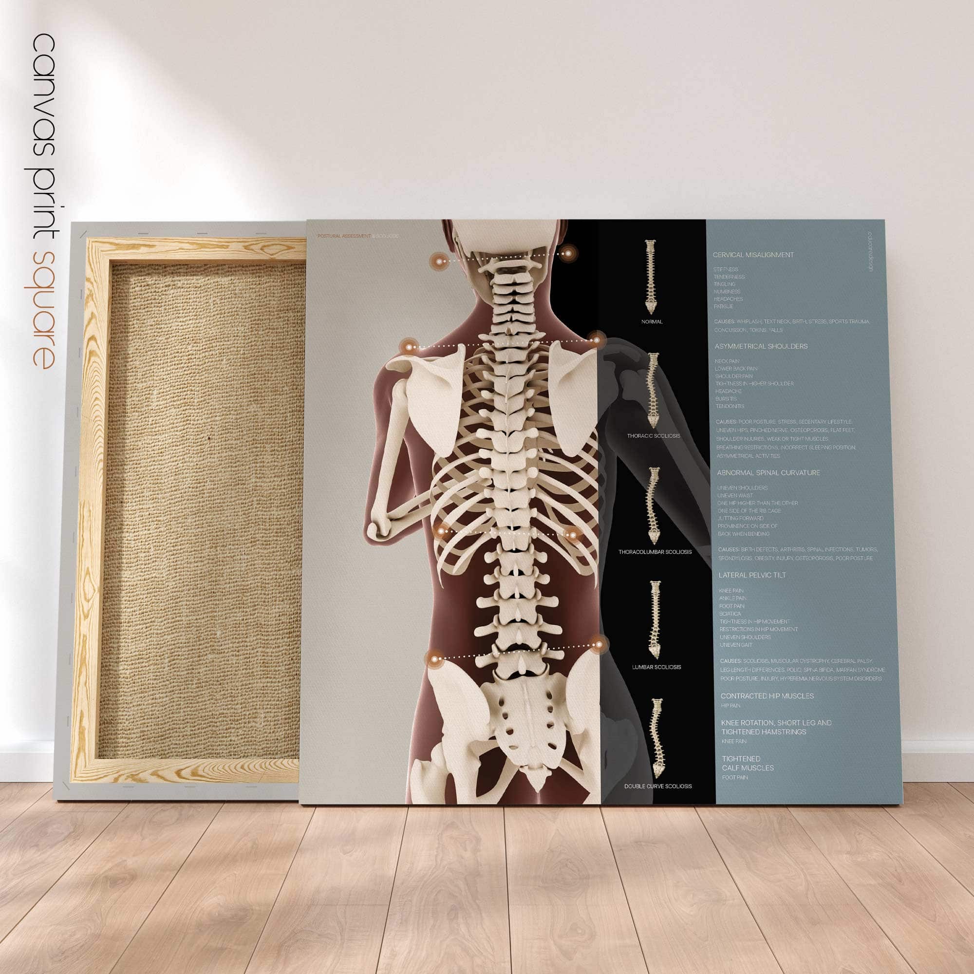 Postural Assessment and Scoliosis. Anatomy and physiology artwork from educare.design
