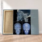 Disturbo dell'ATM. Opere d'arte di anatomia e fisiologia da educare.design