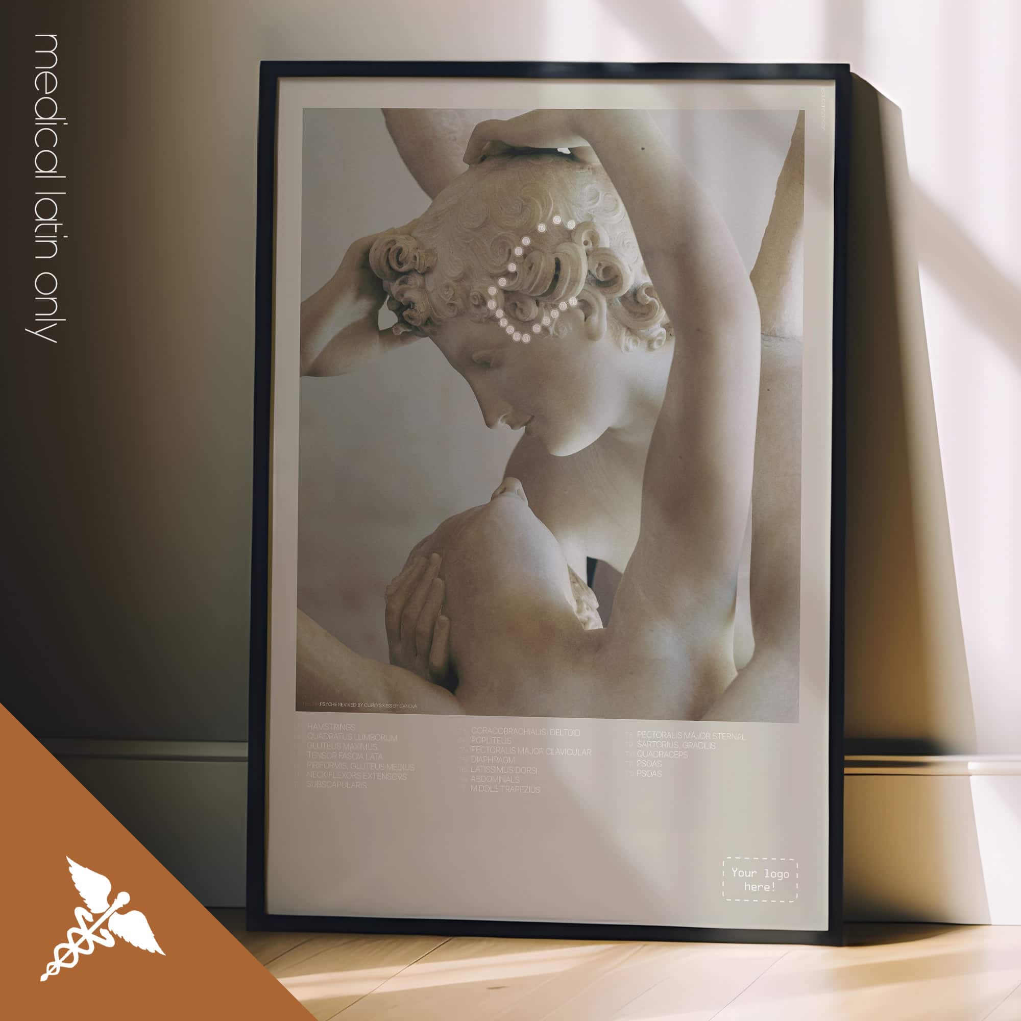 Temporal Sphenoid Line