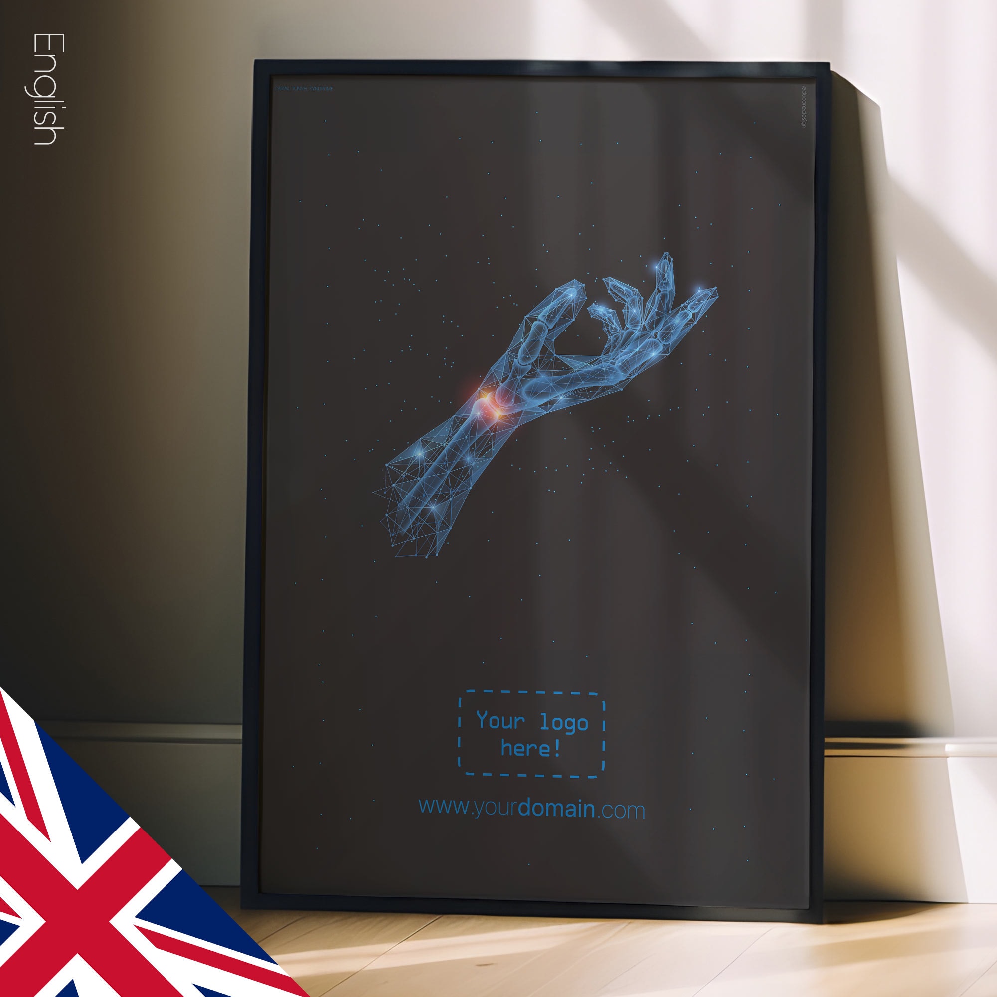 Carpal Tunnel Syndrome — Anatomy Chart