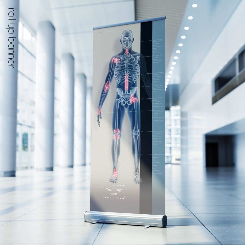 Osteoarthritis. Anatomy and physiology artwork from educare.design