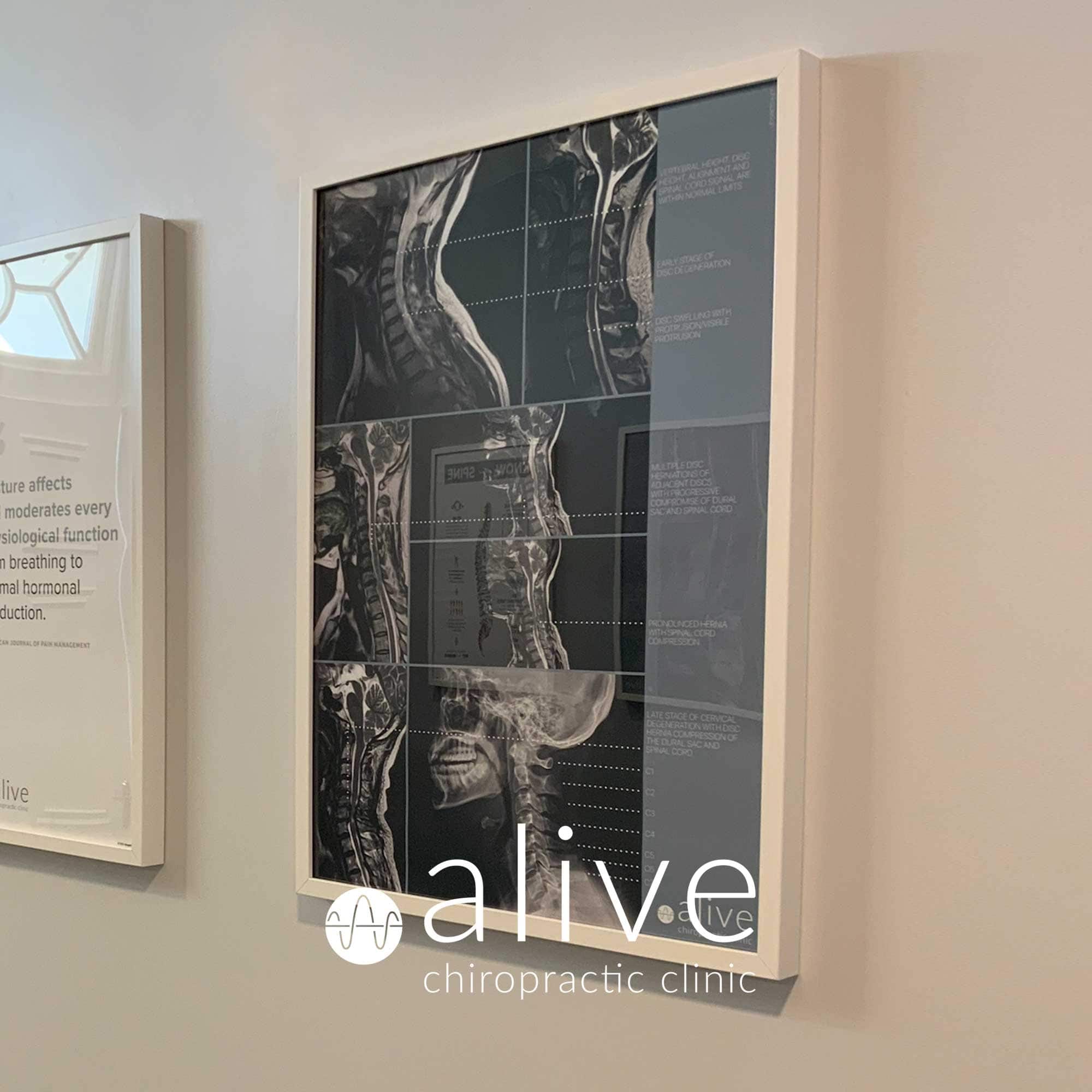 alive chiro 01 – Premium Anatomy Chart by educare.design