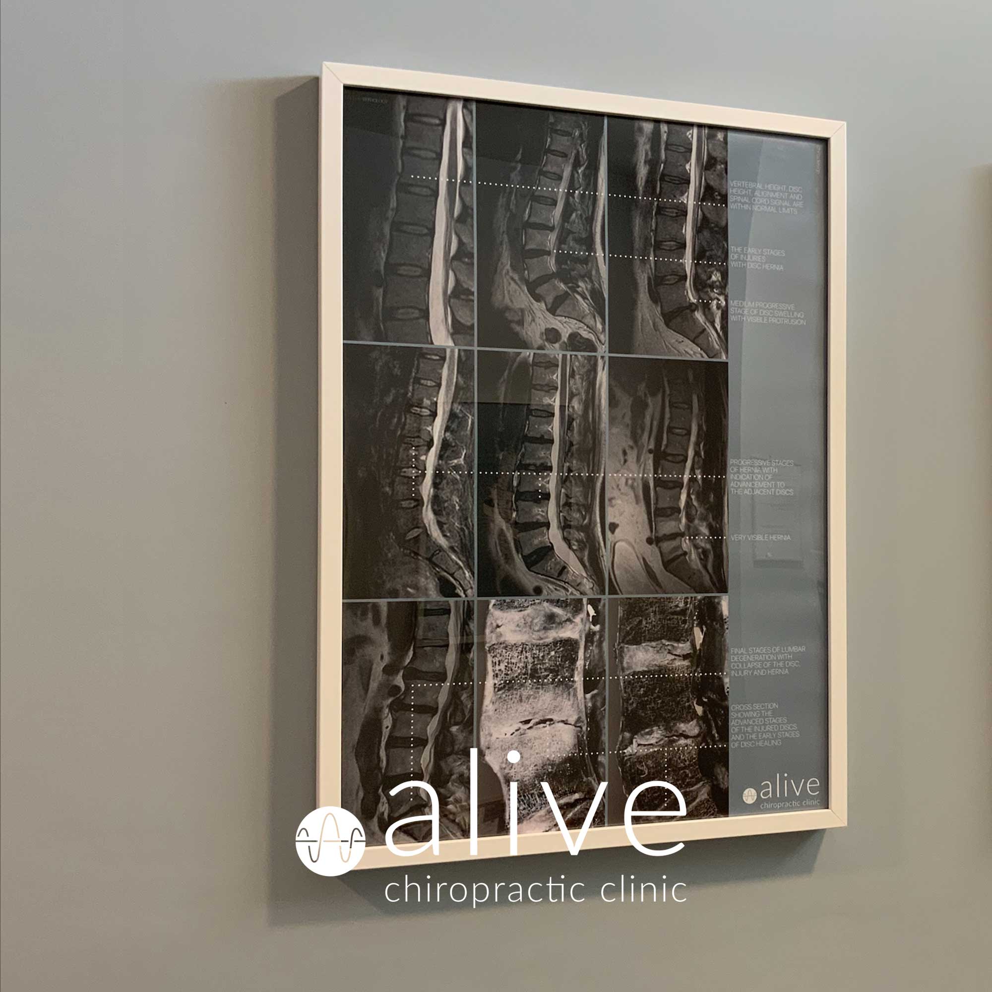 alive chiro 04 – Premium Anatomy Chart by educare.design